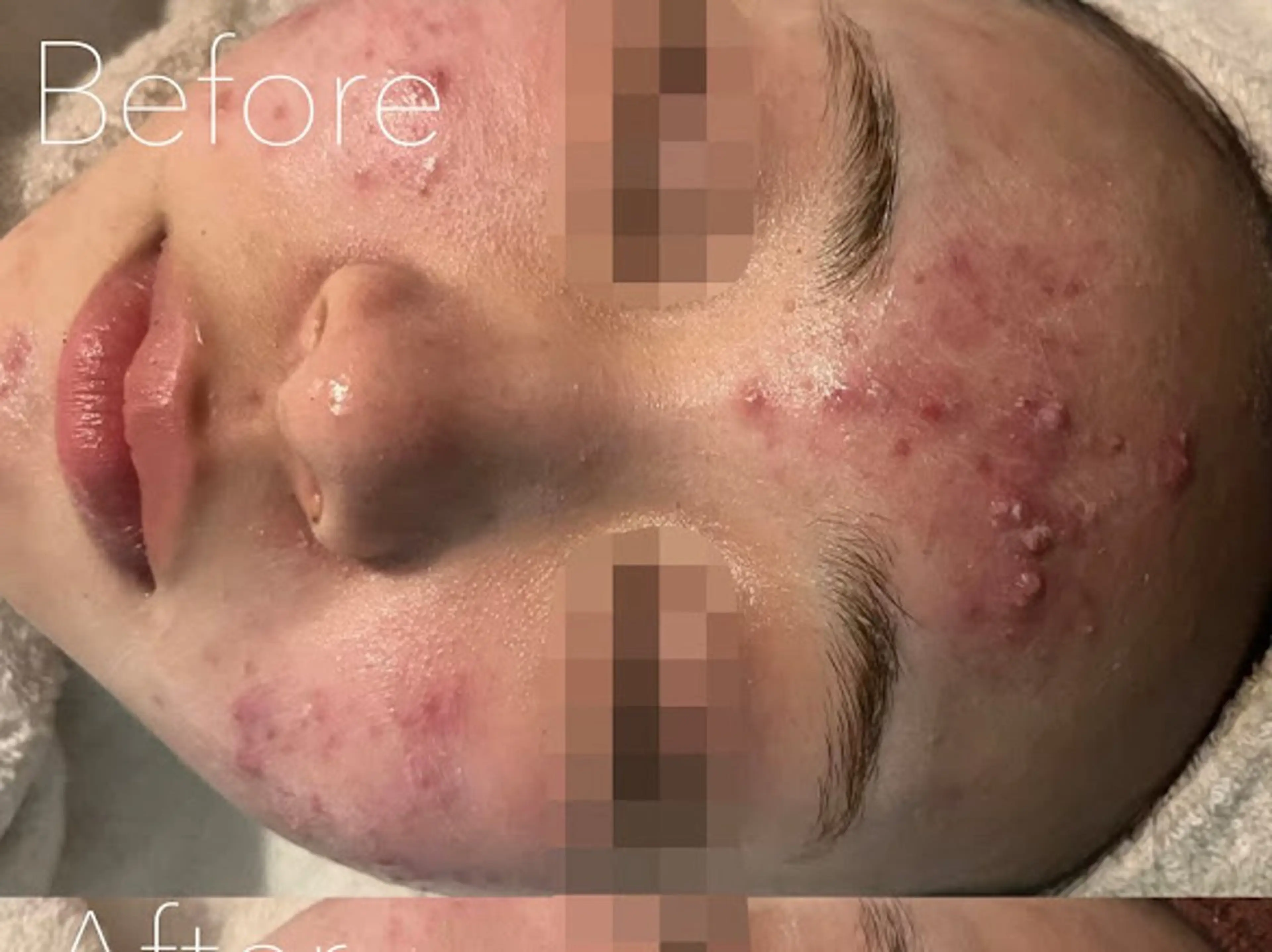 エステ 韓国肌管理Belle 神戸元町のエステ・リラクイメージ