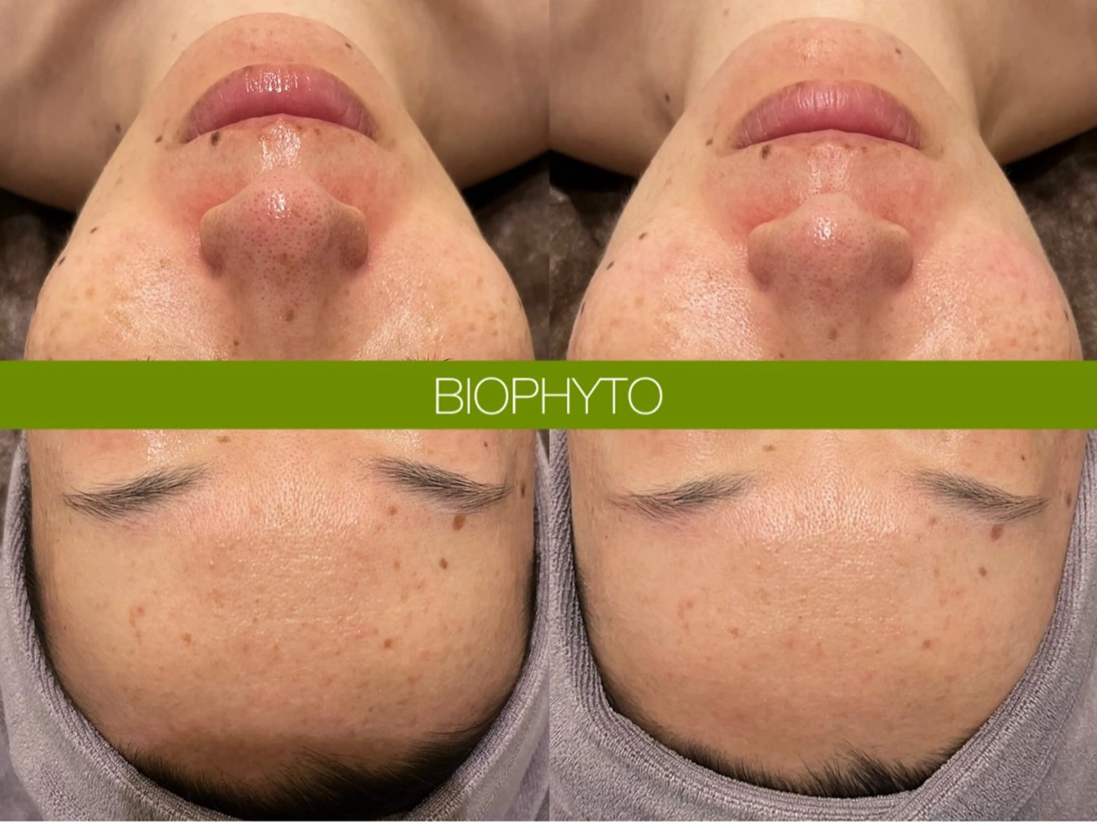 小顔コルギ ☆表参道/外苑前のエステ・リラクイメージ