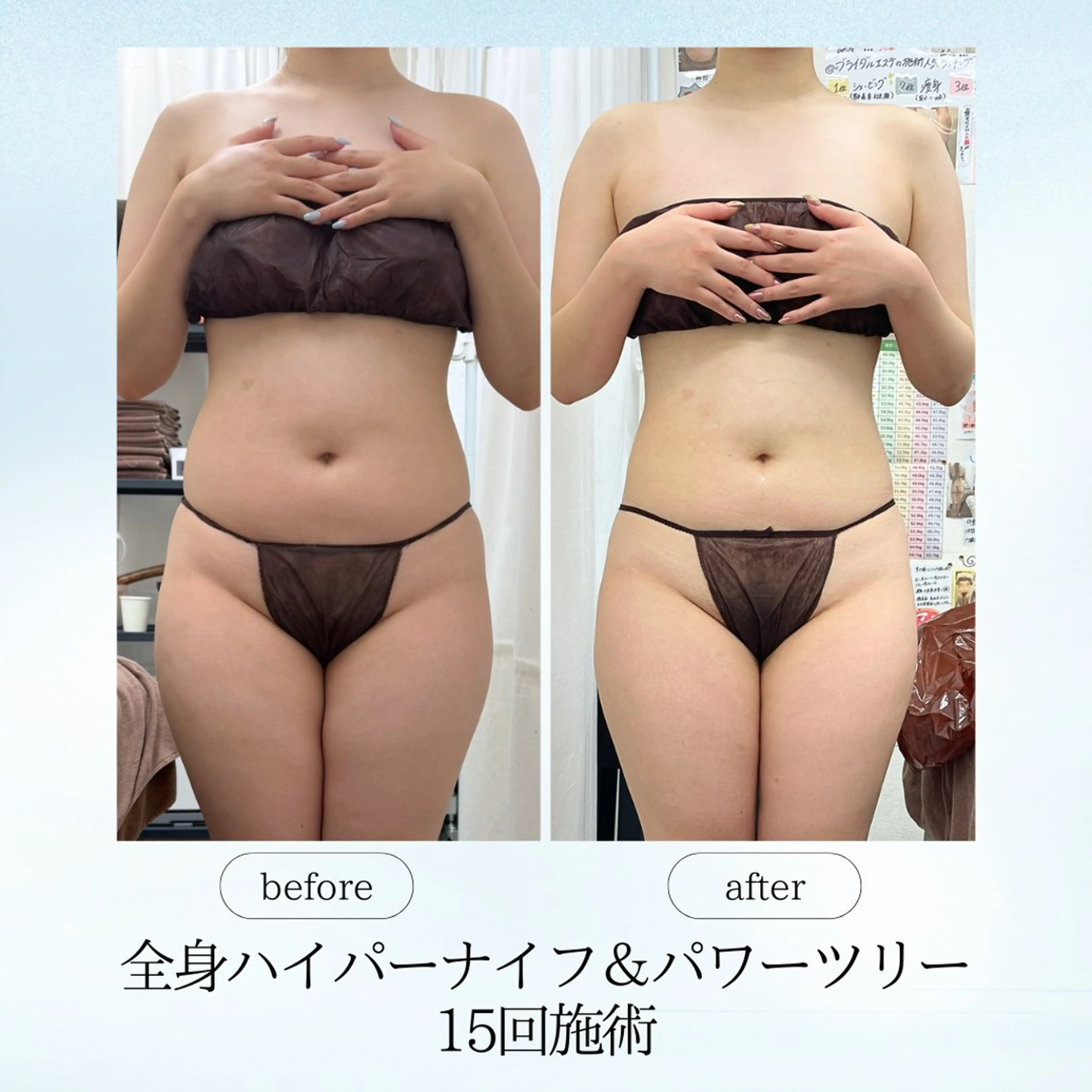 エステ リラク espresso,所属・《痩身、小顔専門店》 エスプレッソのエステ・リラクイメージ