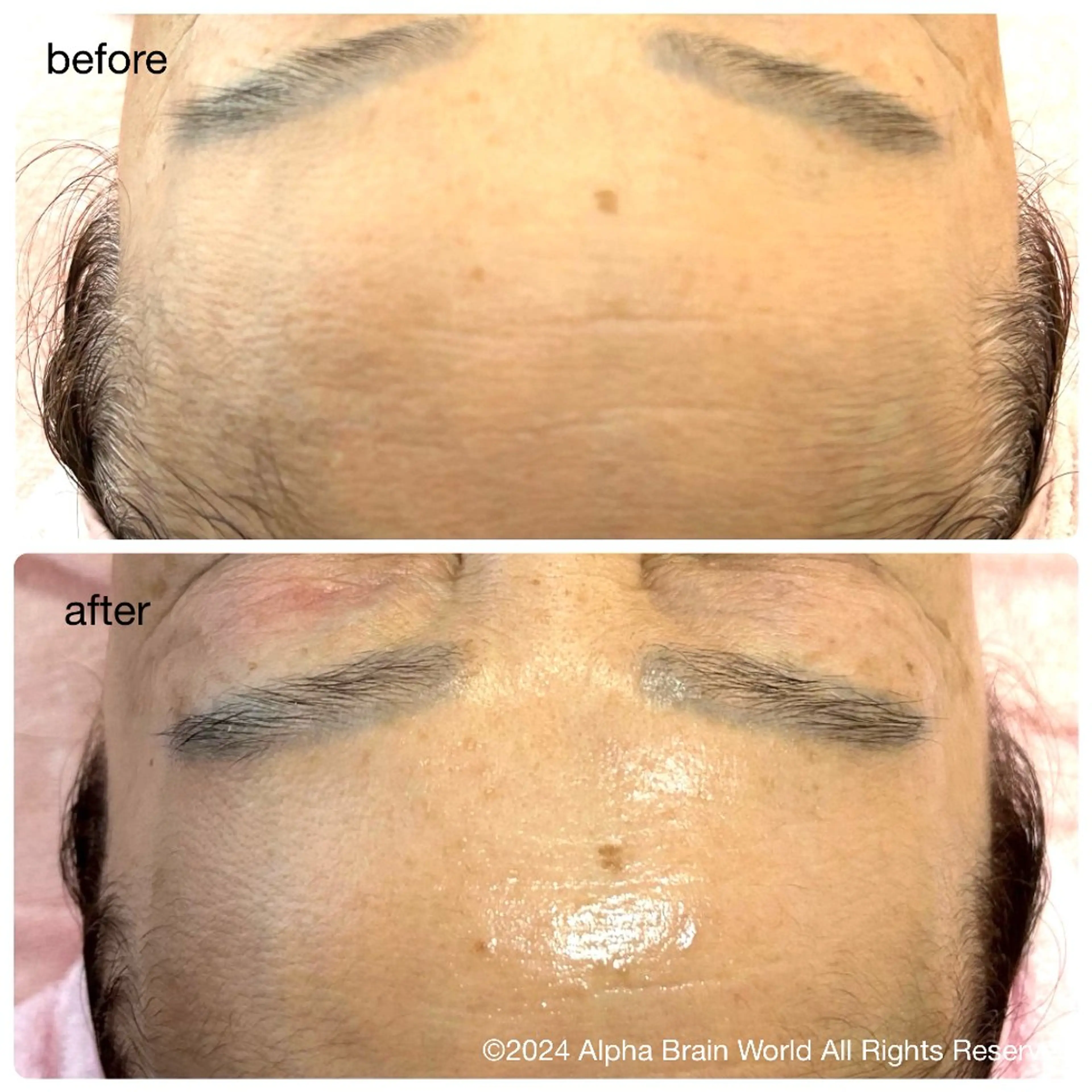 脱毛/美肌【皮膚科看 護師経営】ラベニールのエステ・リラクイメージ