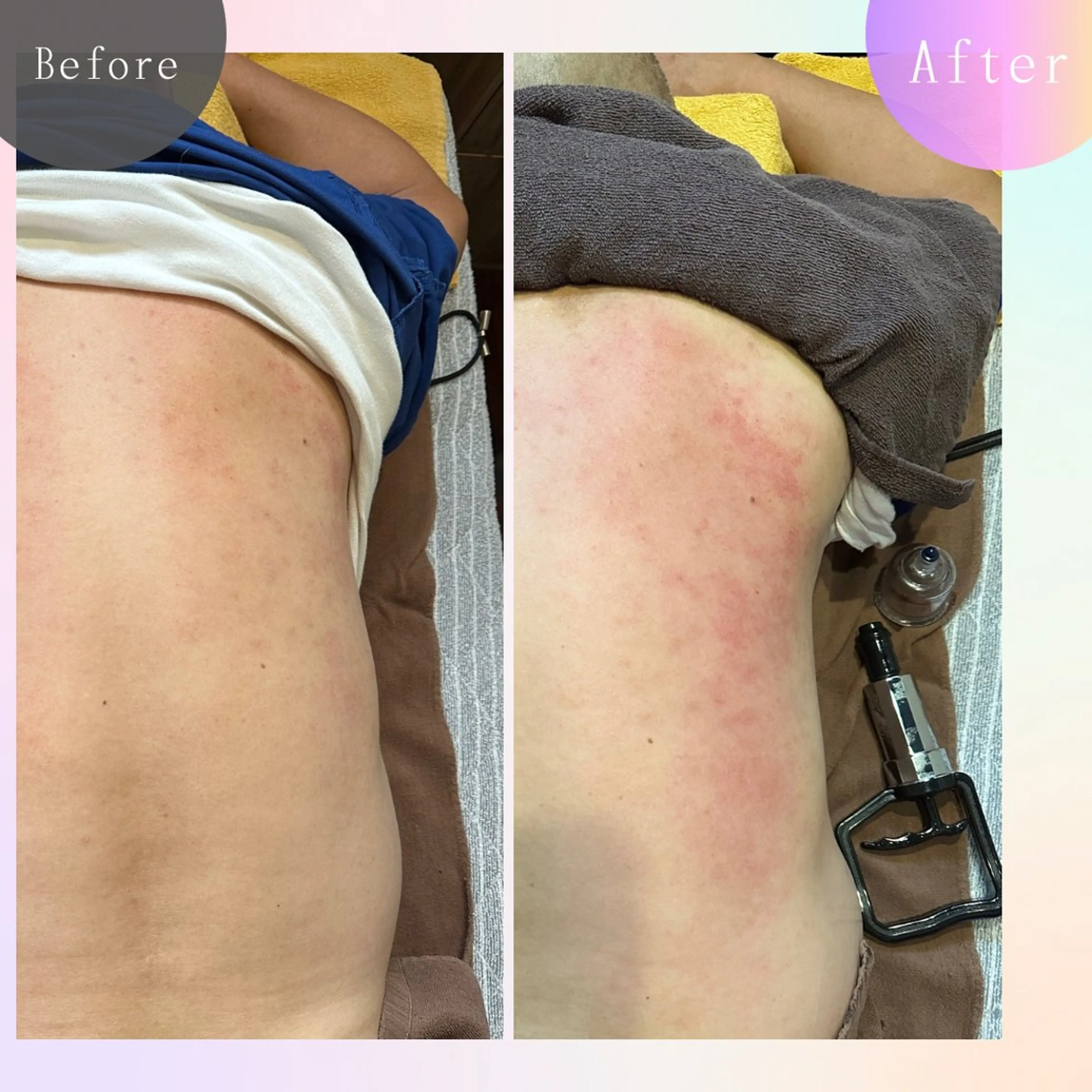 その他 鍼灸院楽々館所属・宇田 碧のエステ・リラクイメージ