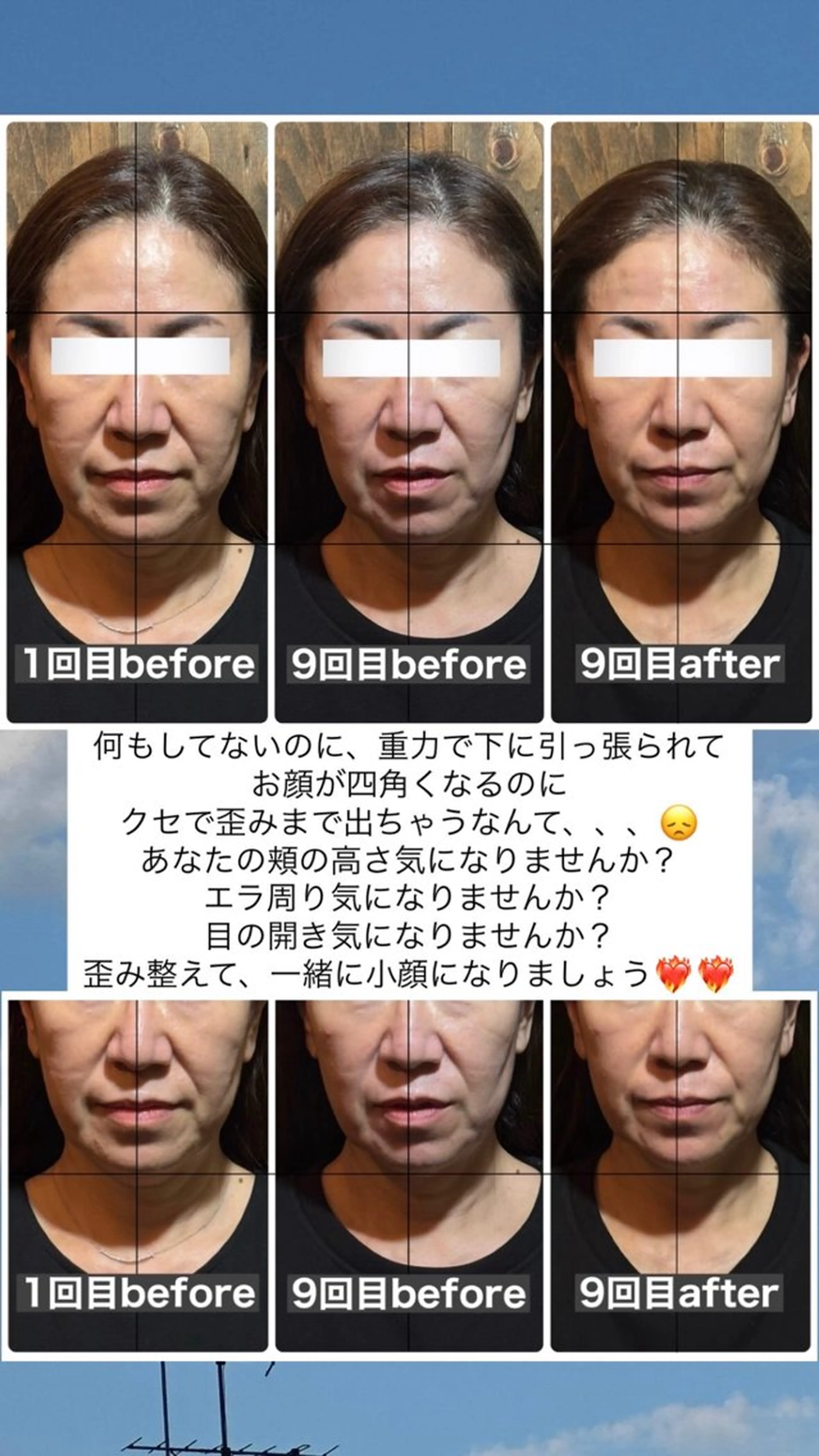 エステ リラク 💎後悔させない小顔 矯正💎イトヤマ🌱のエステ・リラクイメージ