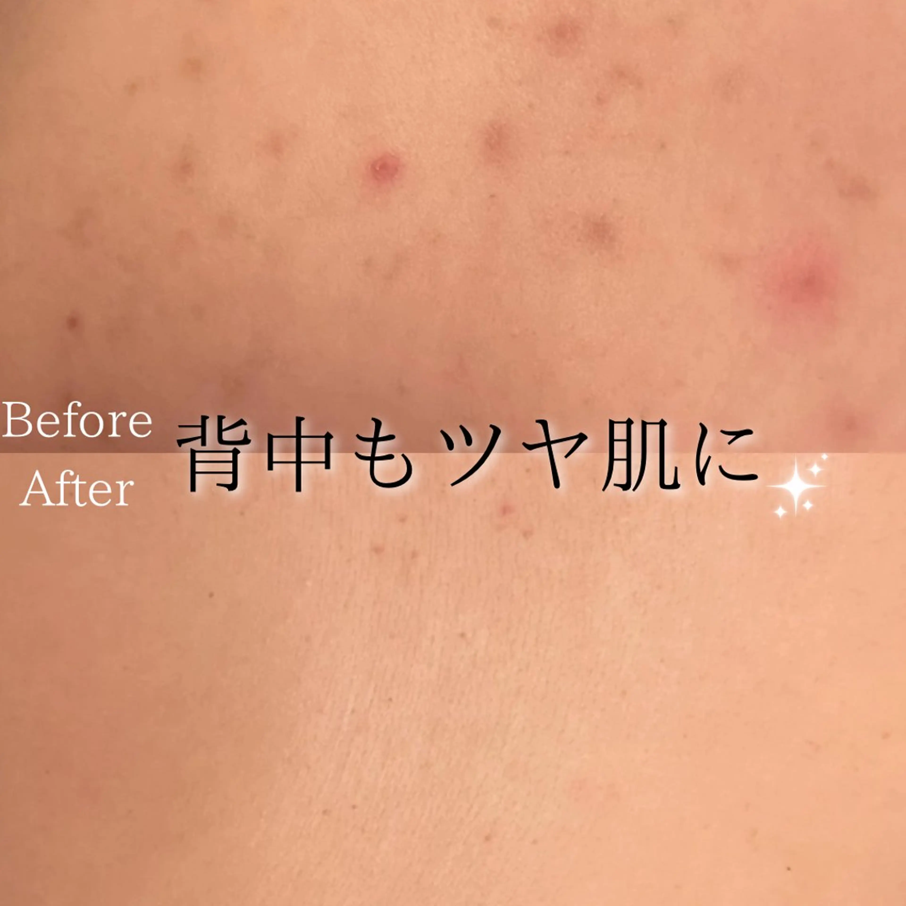 エステ Ginza Charerのエステ・リラクイメージ