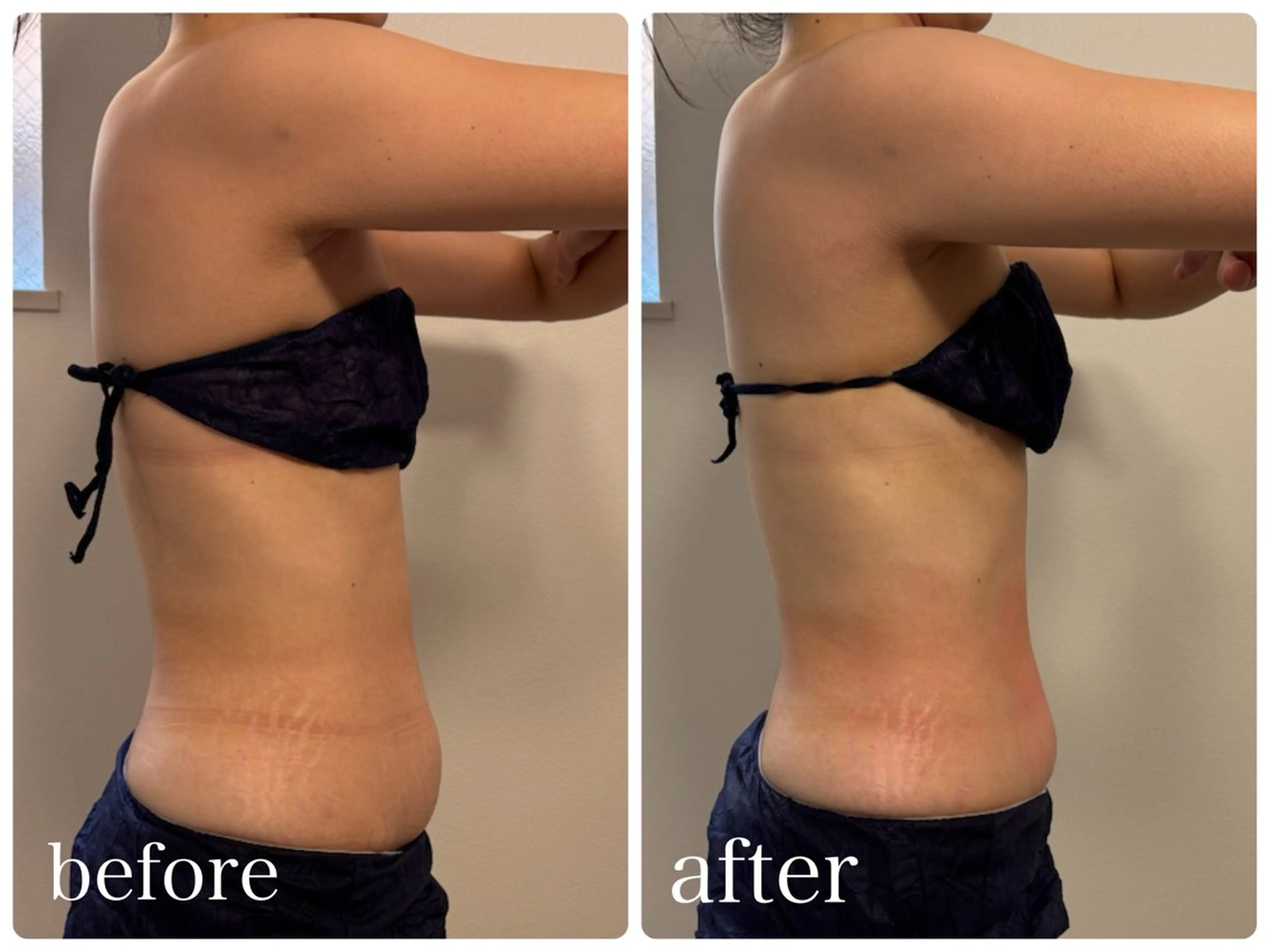 エステ 23beauty所属・武藤 那月のエステ・リラクイメージ