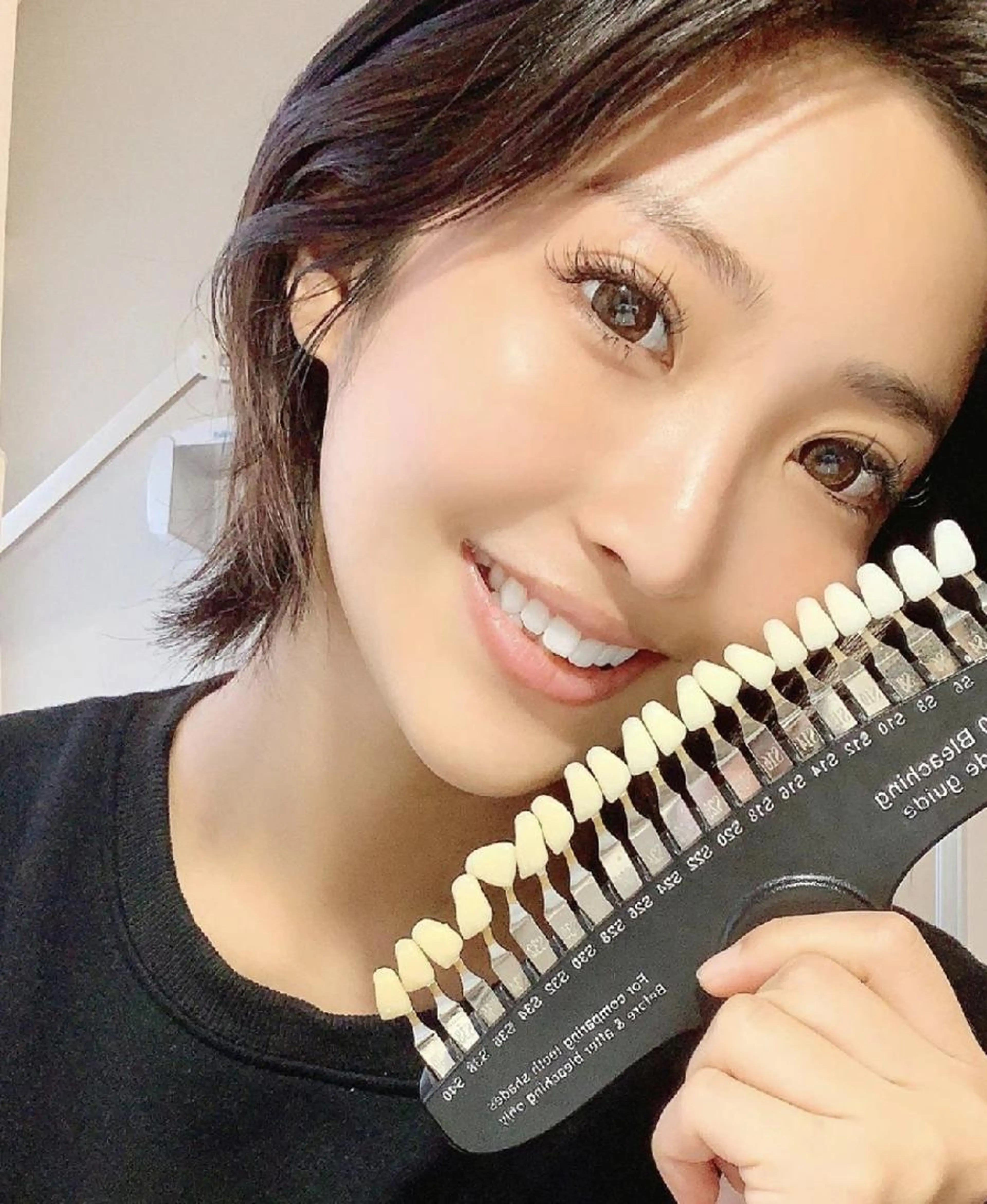 《初回限定プラン✨》強力集中ケア❕ごっそり着色抜けます 😃💕 ハイパワーホワイトニング8分5照射の写真