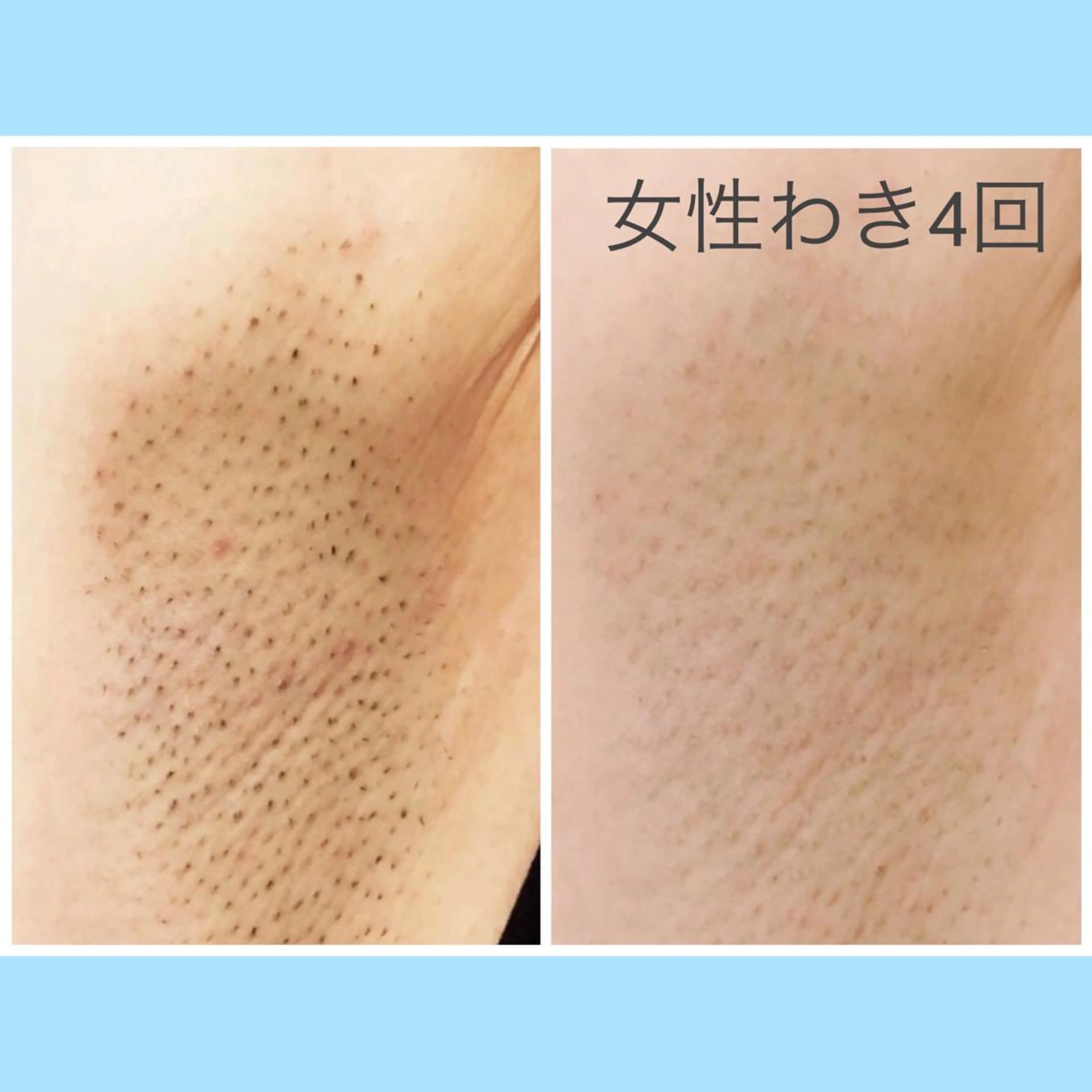 🌿Anis 🌿のマツエク・マツパデザイン