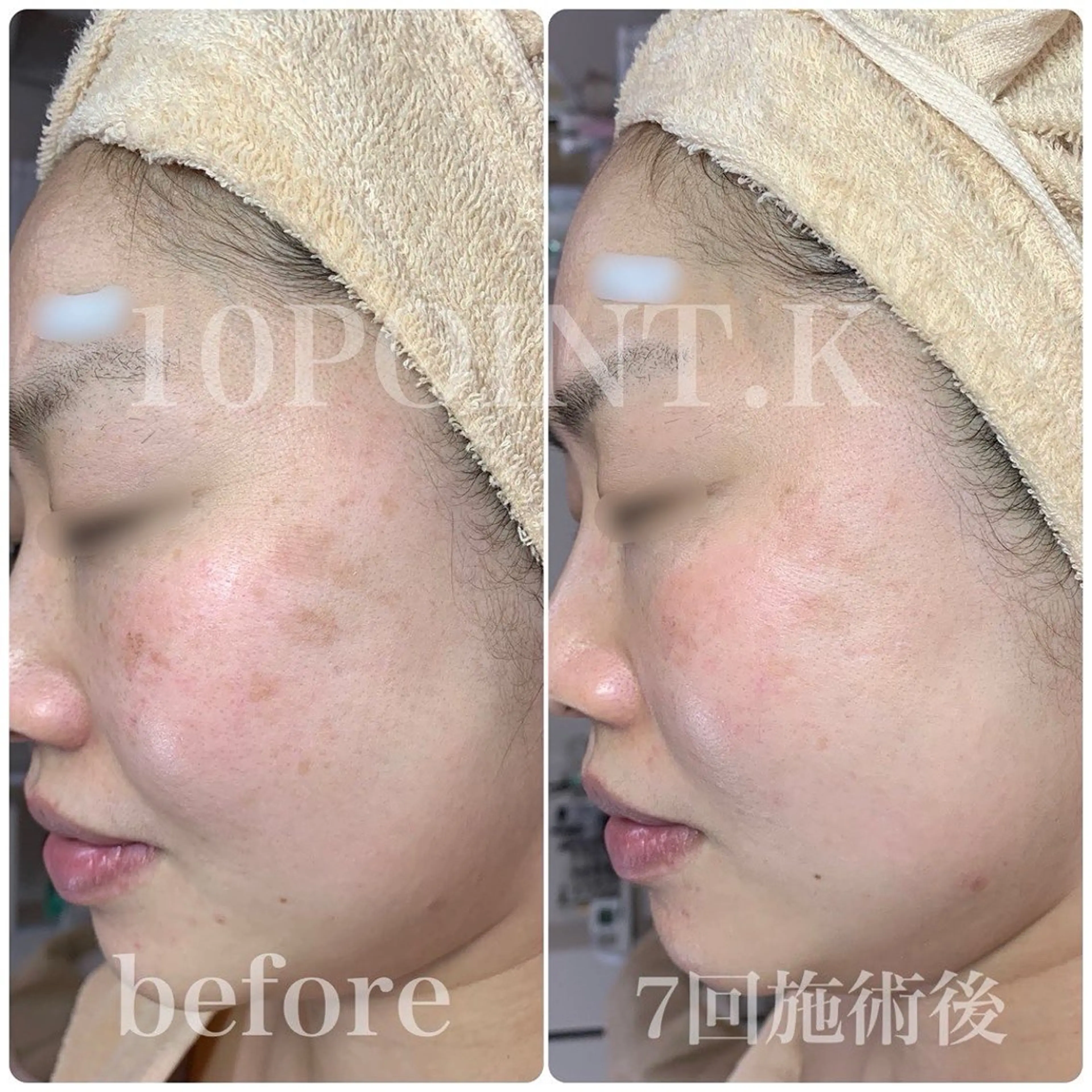 シミケア専門サロン 10POINT.Kのエステ・リラクイメージ