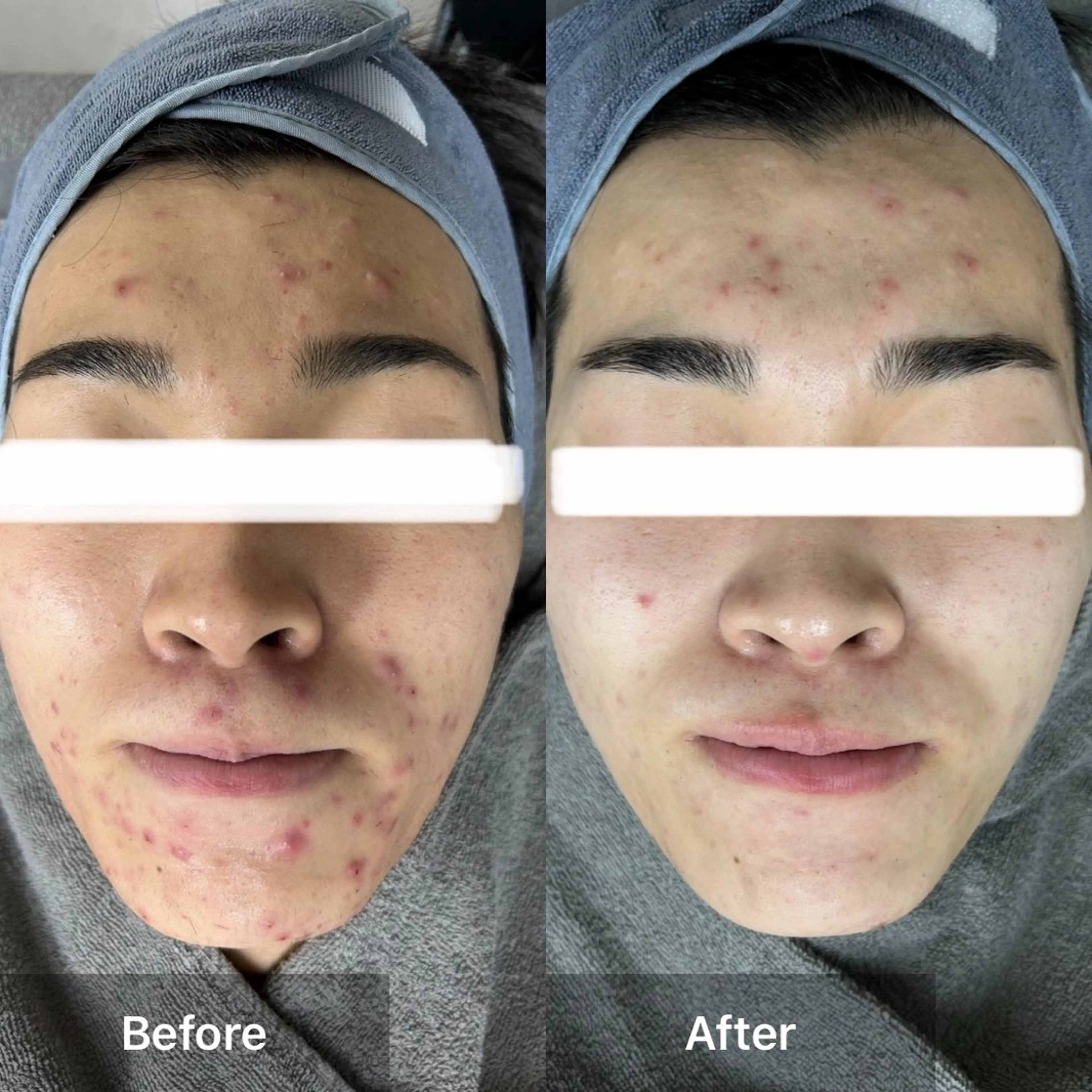 エステ ハーブピーリング専門 MOKAのエステ・リラクイメージ