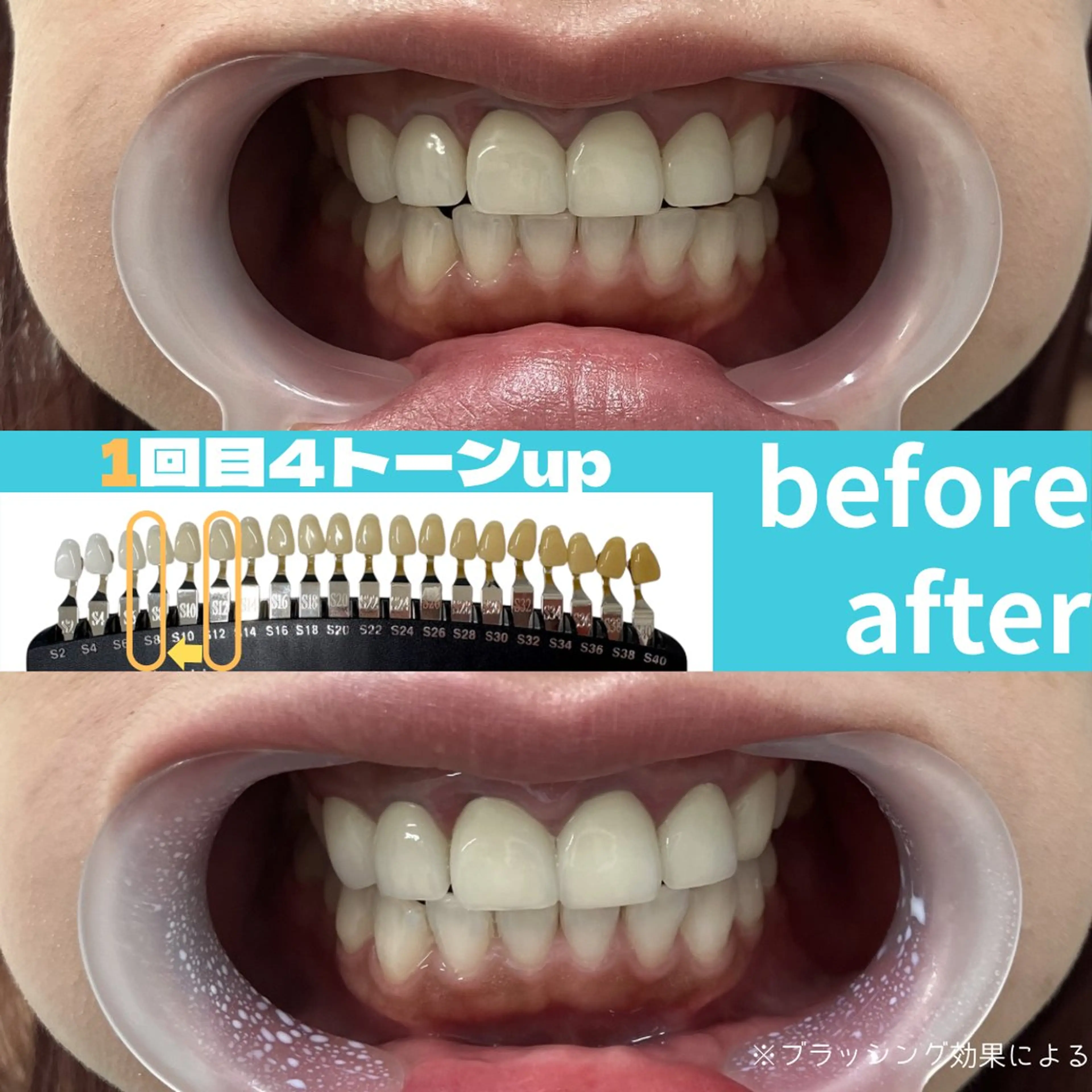 エステ s rikoのエステ・リラクイメージ