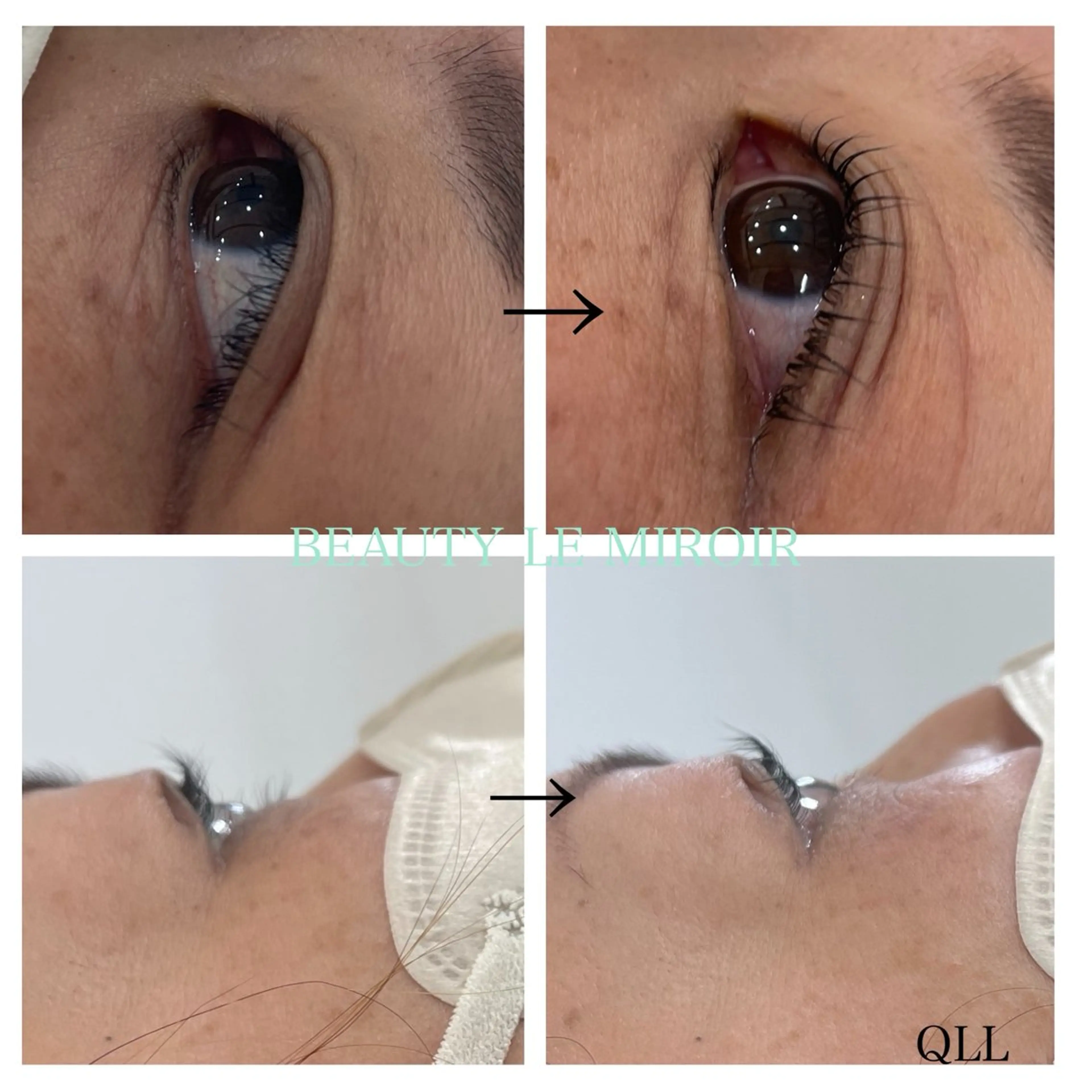 マツエク・マツパ ビューティー ミロワールのエステ・リラクイメージ