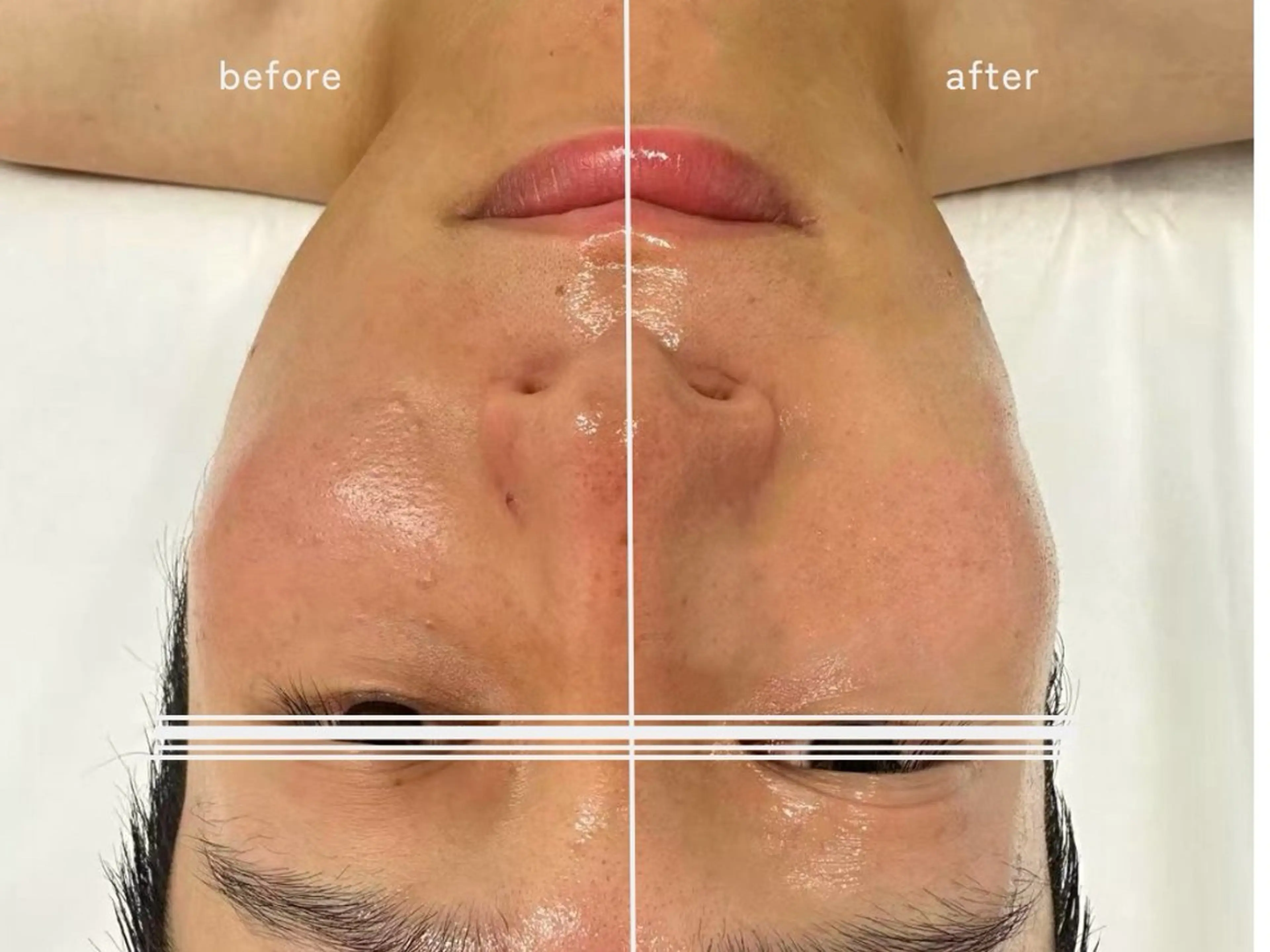 洗顔サロン池袋 毛穴洗浄のその他イメージ