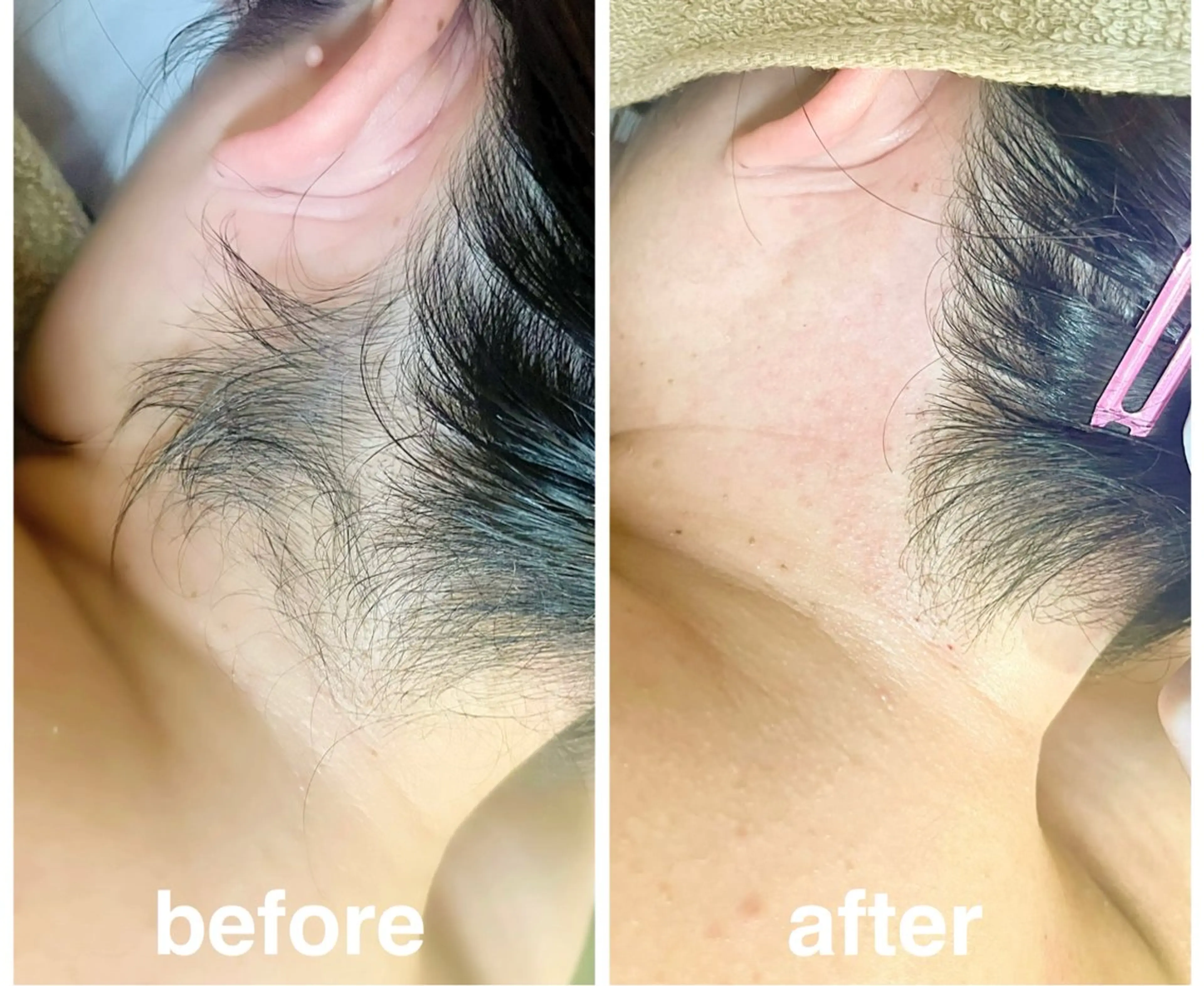 脱毛 【 十美 】 ENDOのエステ・リラクイメージ