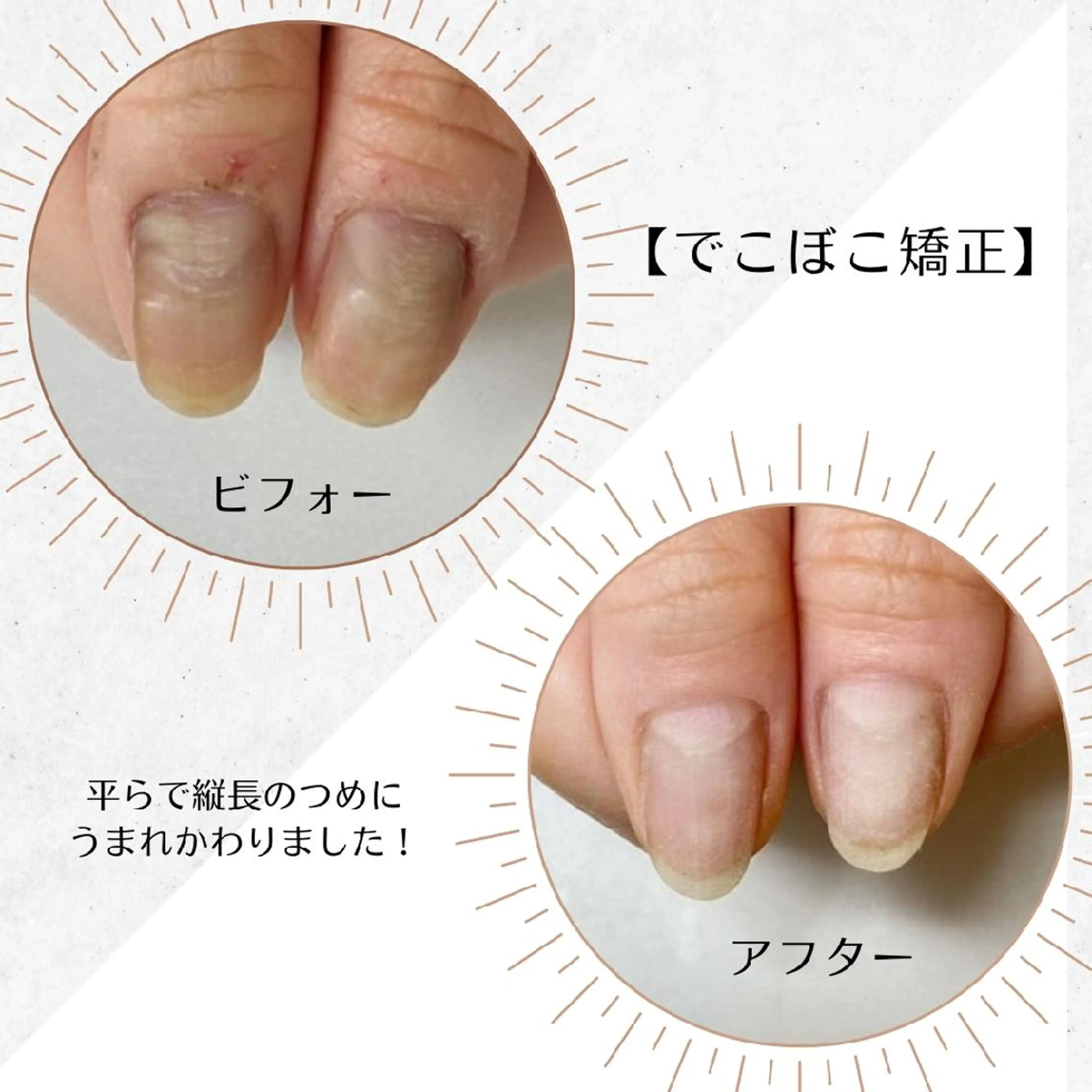 ネイル ネイルサロン アリュームのネイルデザイン