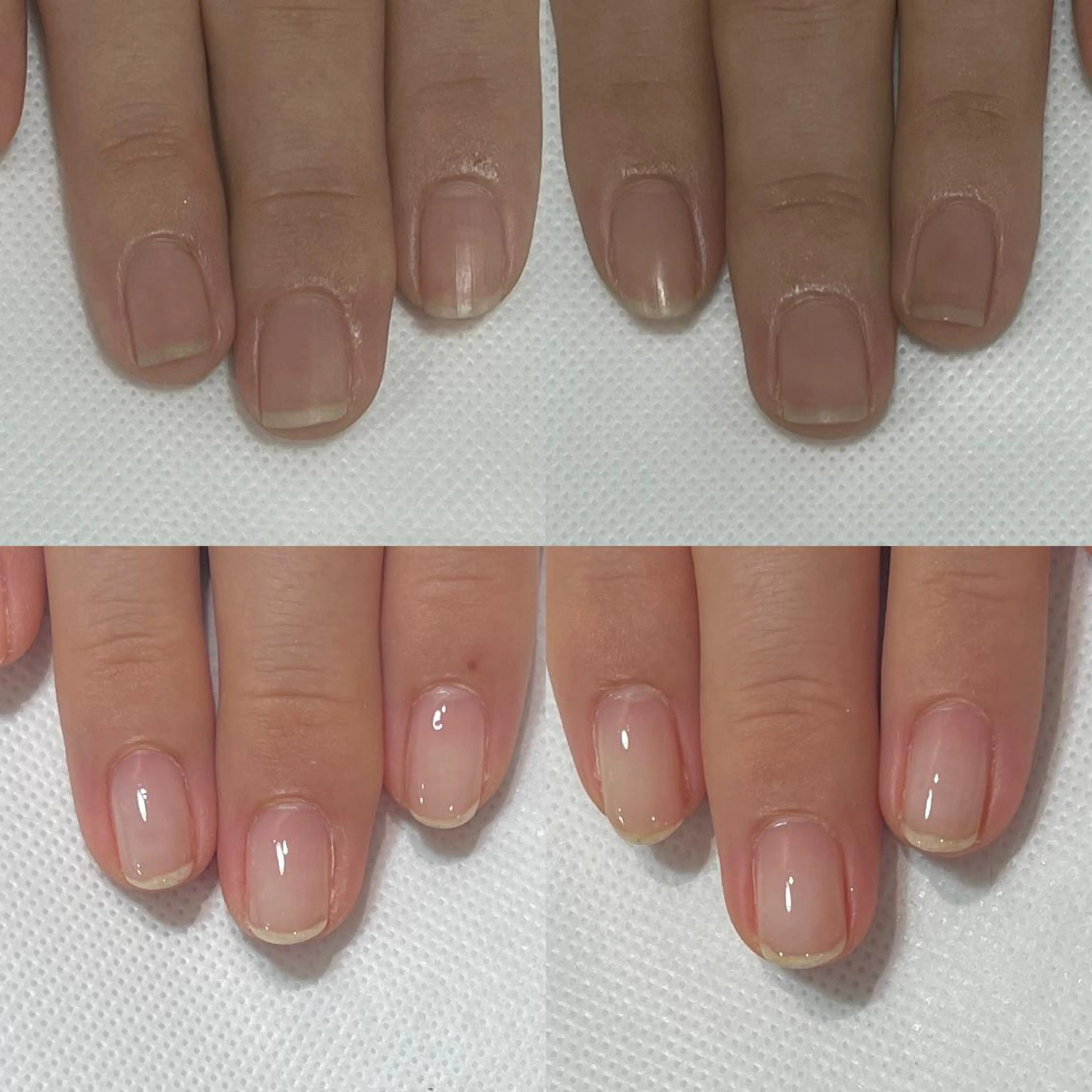 ネイル 自爪育成・巻き爪 補正講師　津蔵のネイルデザイン