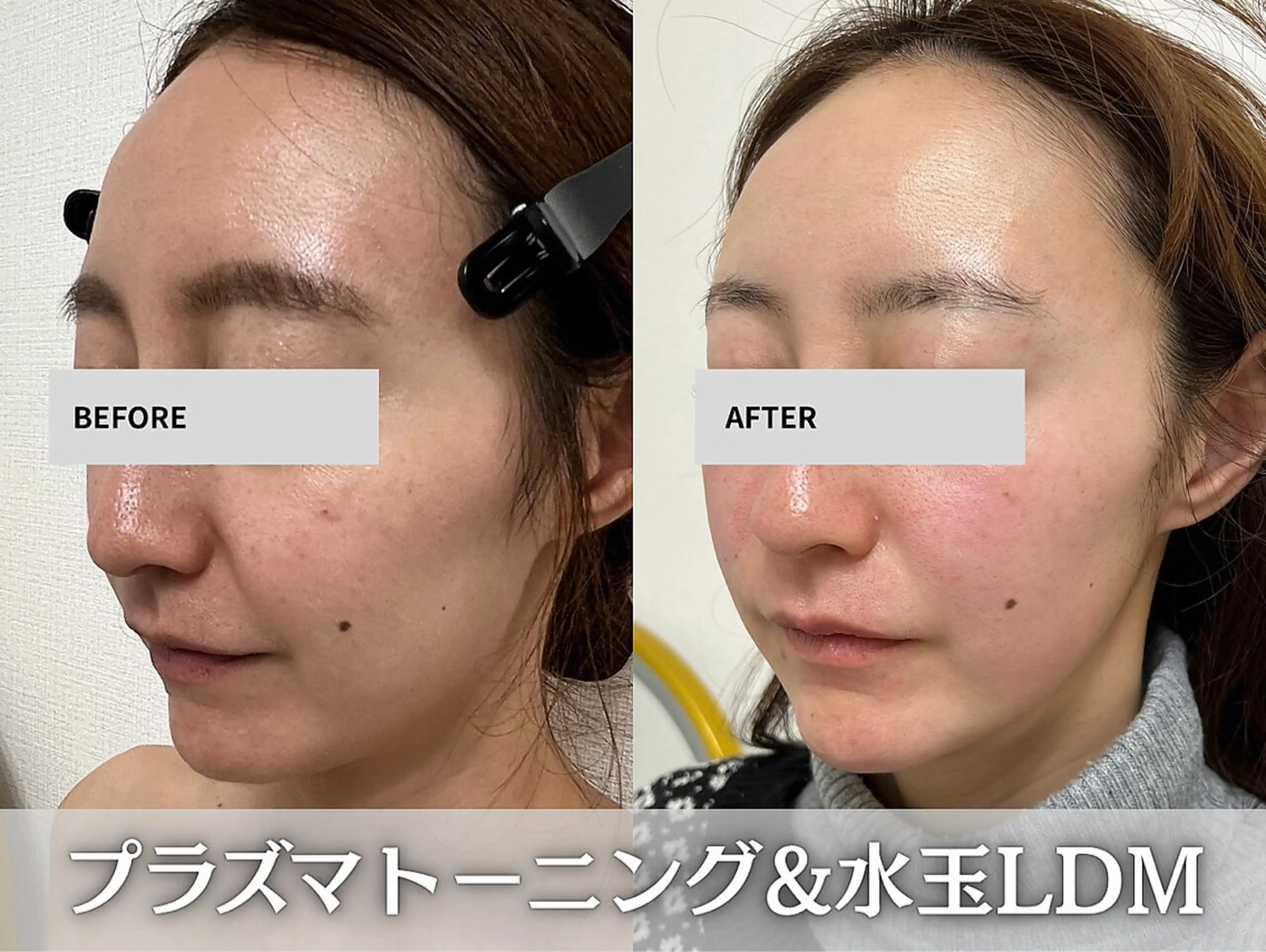 aimer 服部のその他イメージ