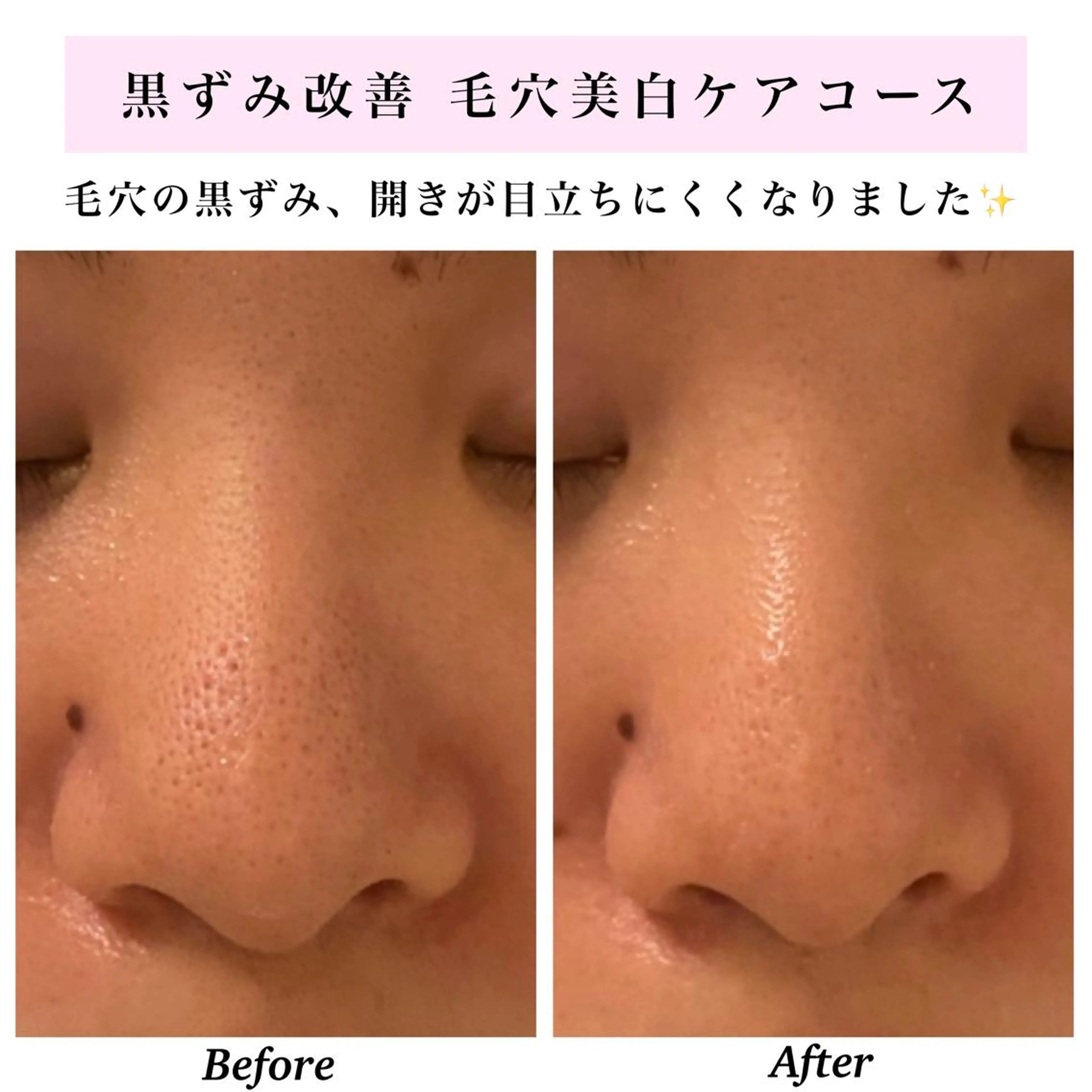 エステ リラク Bellesthe （ベルエステ）のエステ・リラクイメージ