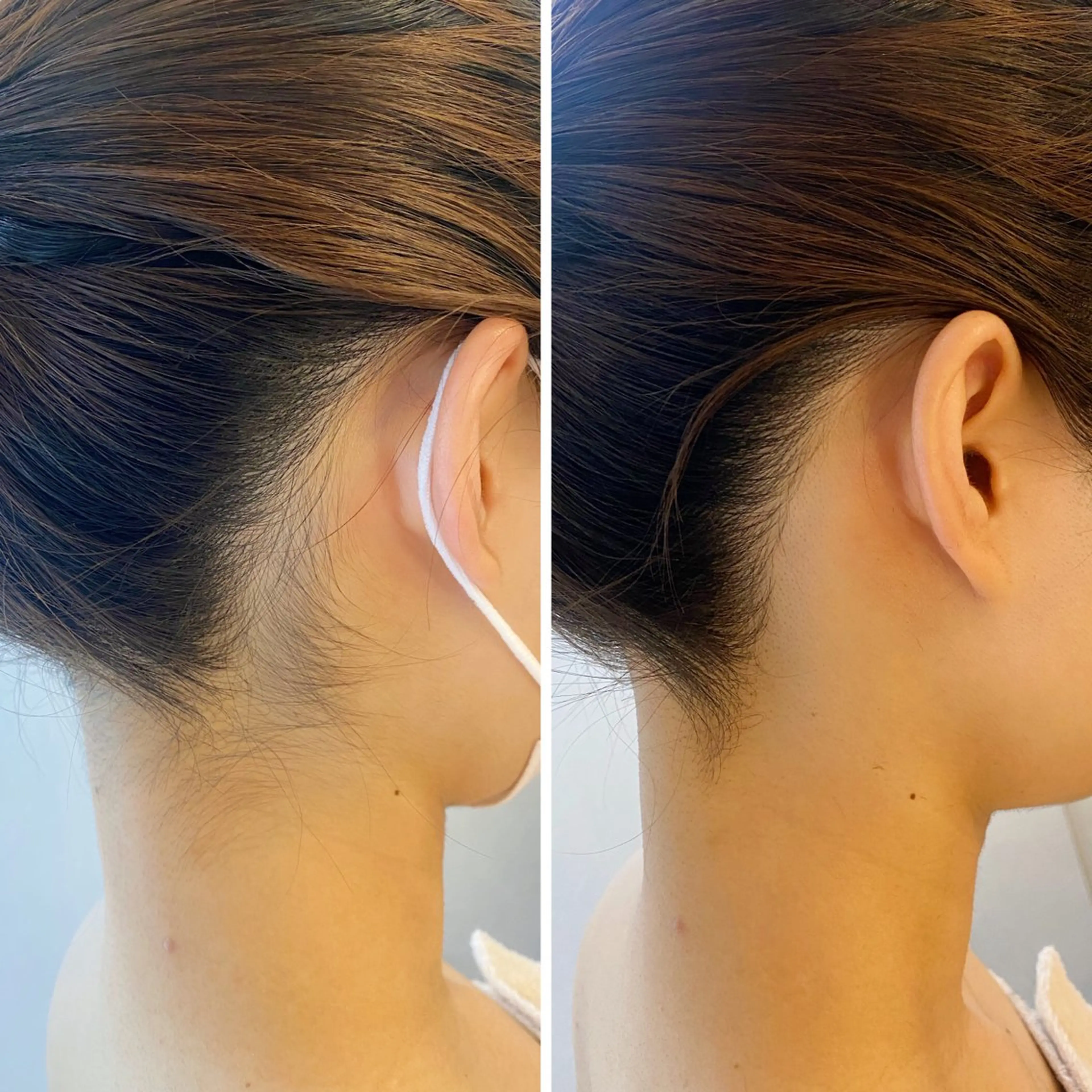 うなじ脱毛/美肌脱毛 LABELのエステ・リラクイメージ