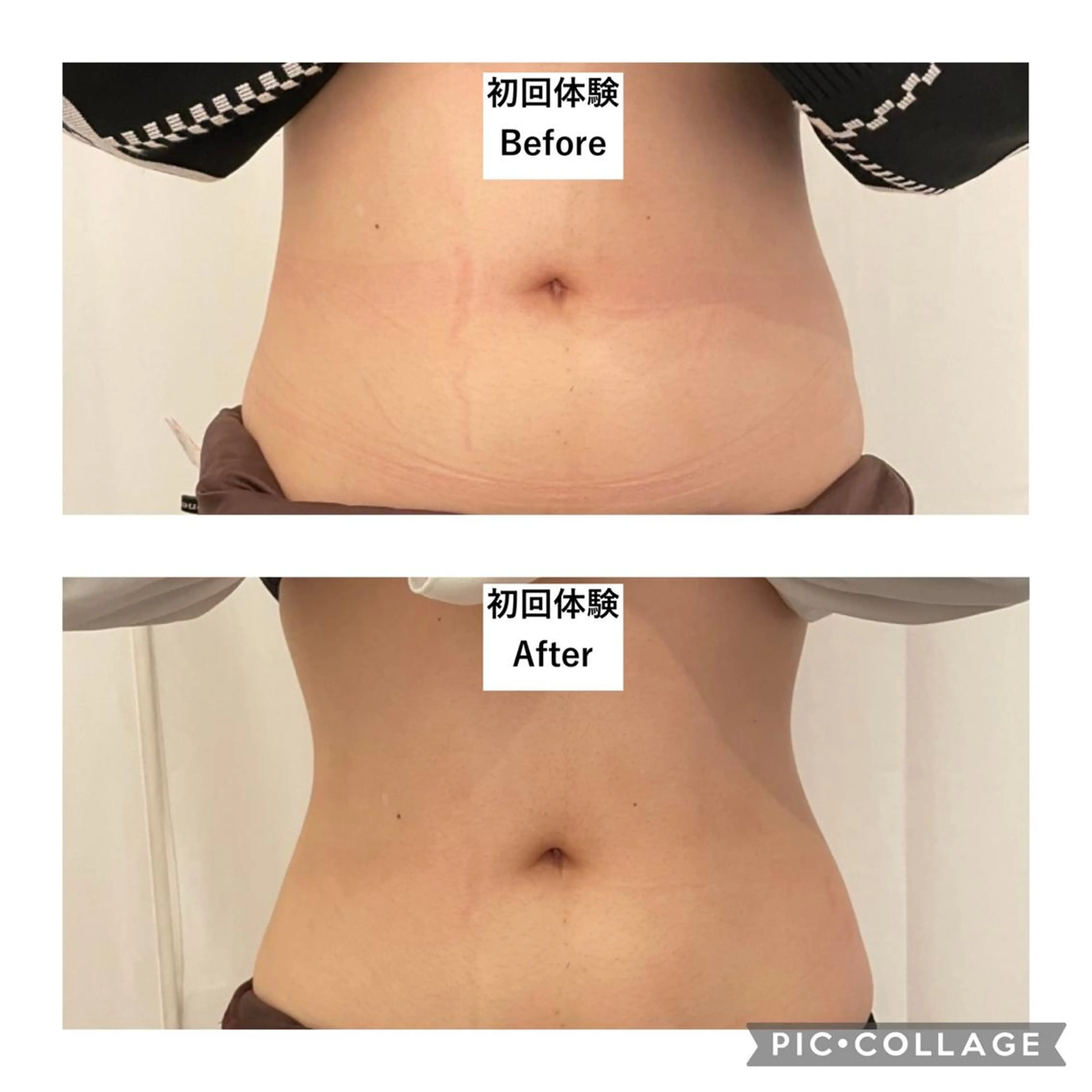 12Dハイフ💗 最強小顔のエステ・リラクイメージ