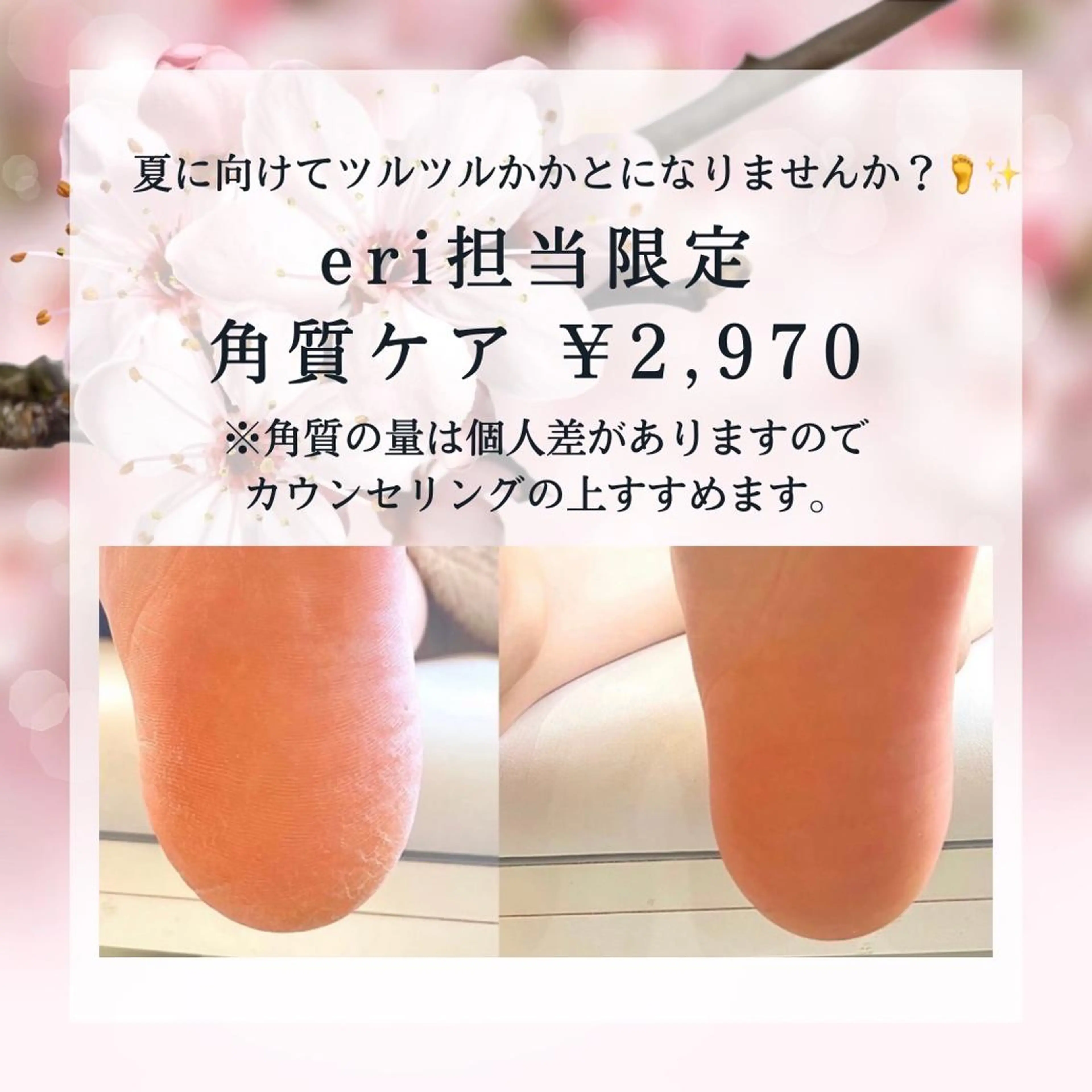 ネイル BURGUNDY 🌹eriのネイルデザイン