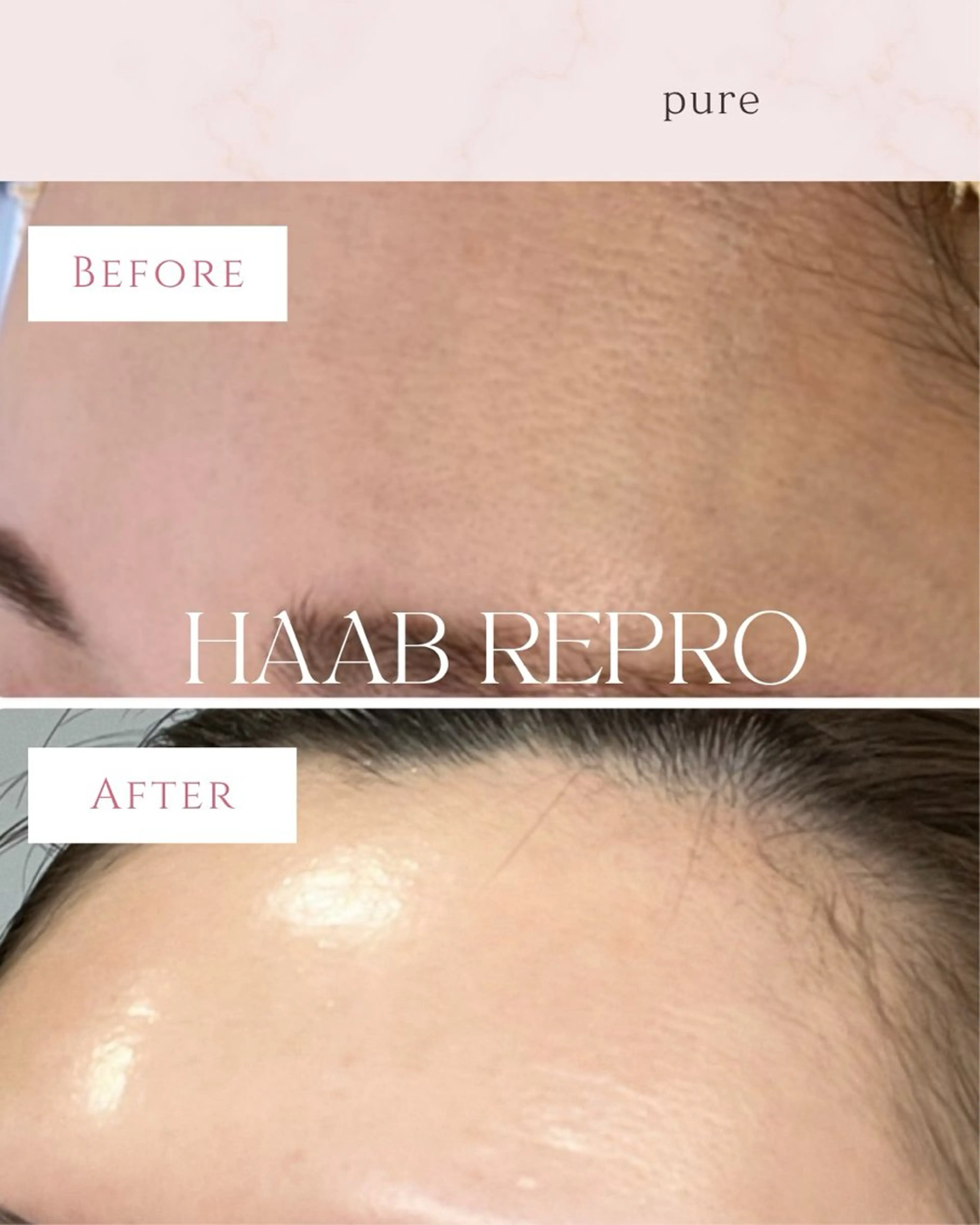 pure所属・肌質改善ピーリング pure 一番町のエステ・リラクイメージ