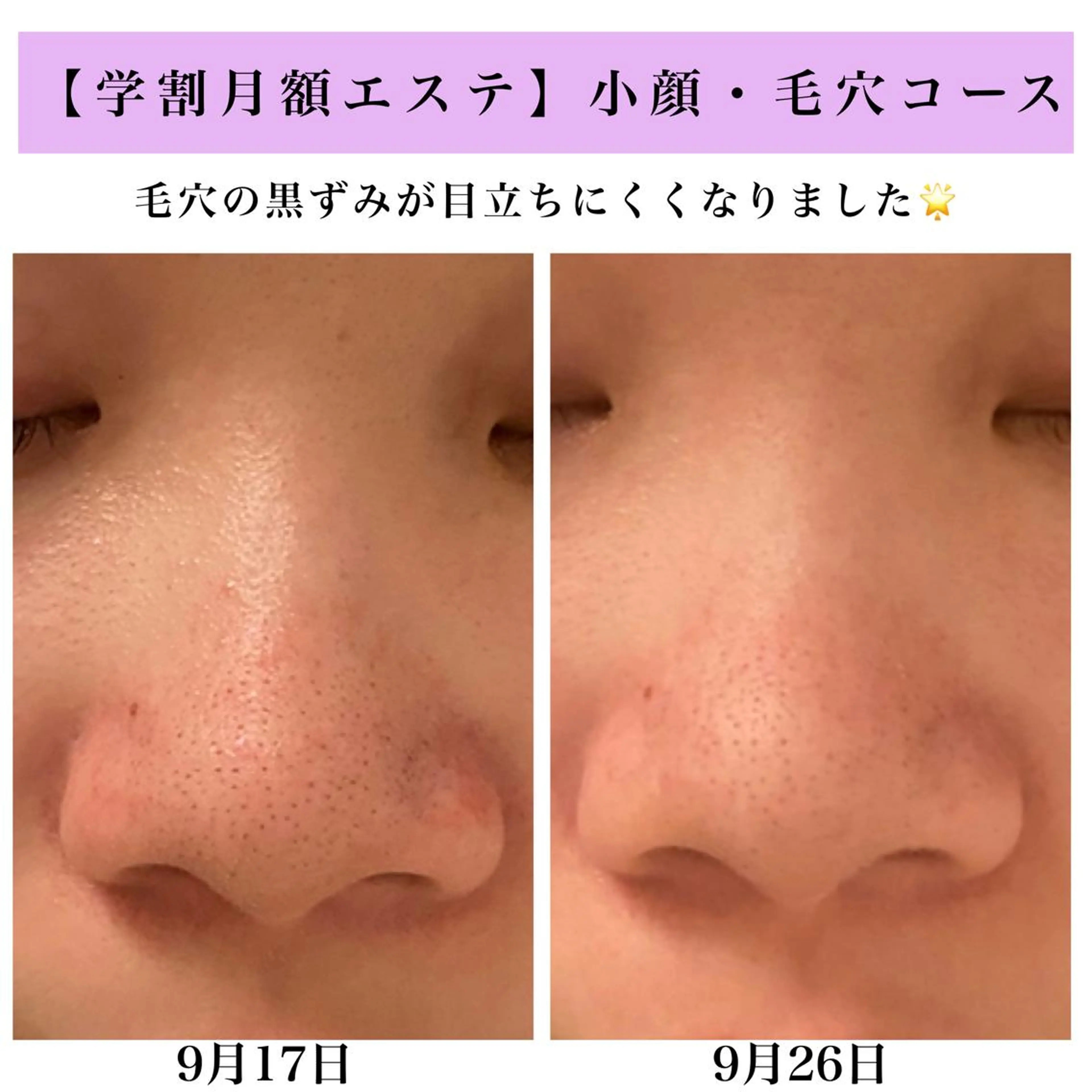 Bellesthe （ベルエステ）のエステ・リラクイメージ