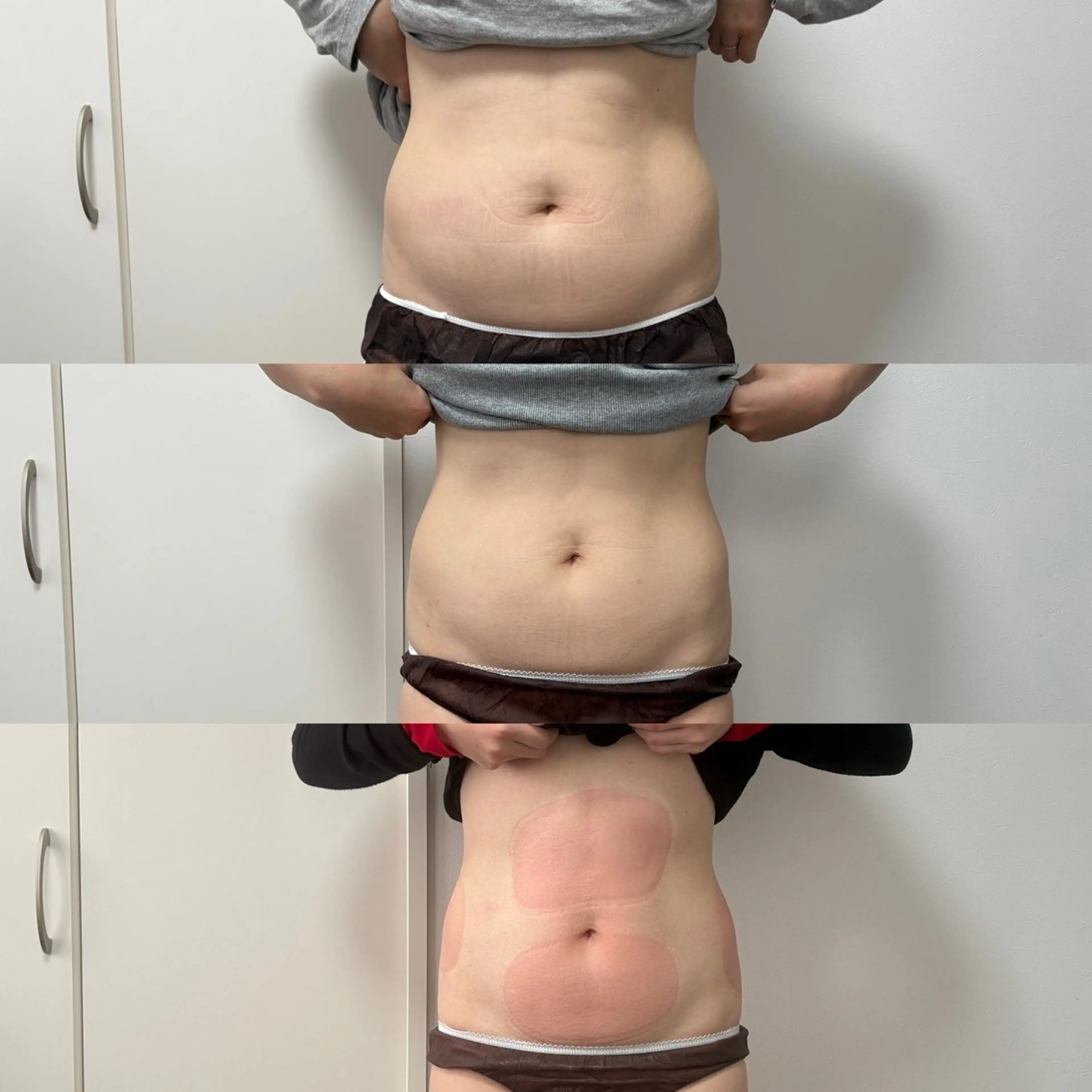 Miiju.所属・石巻 冷却痩身 Miiju. 鈴木のエステ・リラクイメージ