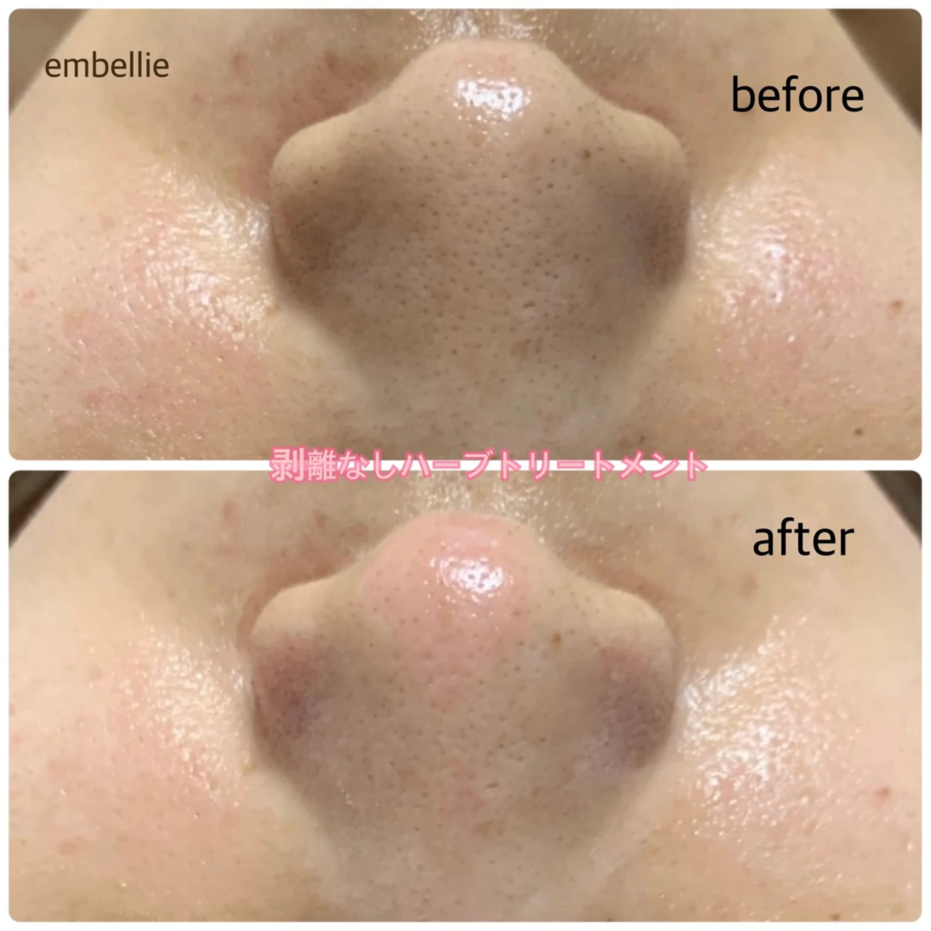 miyasaka erikoのネイルデザイン