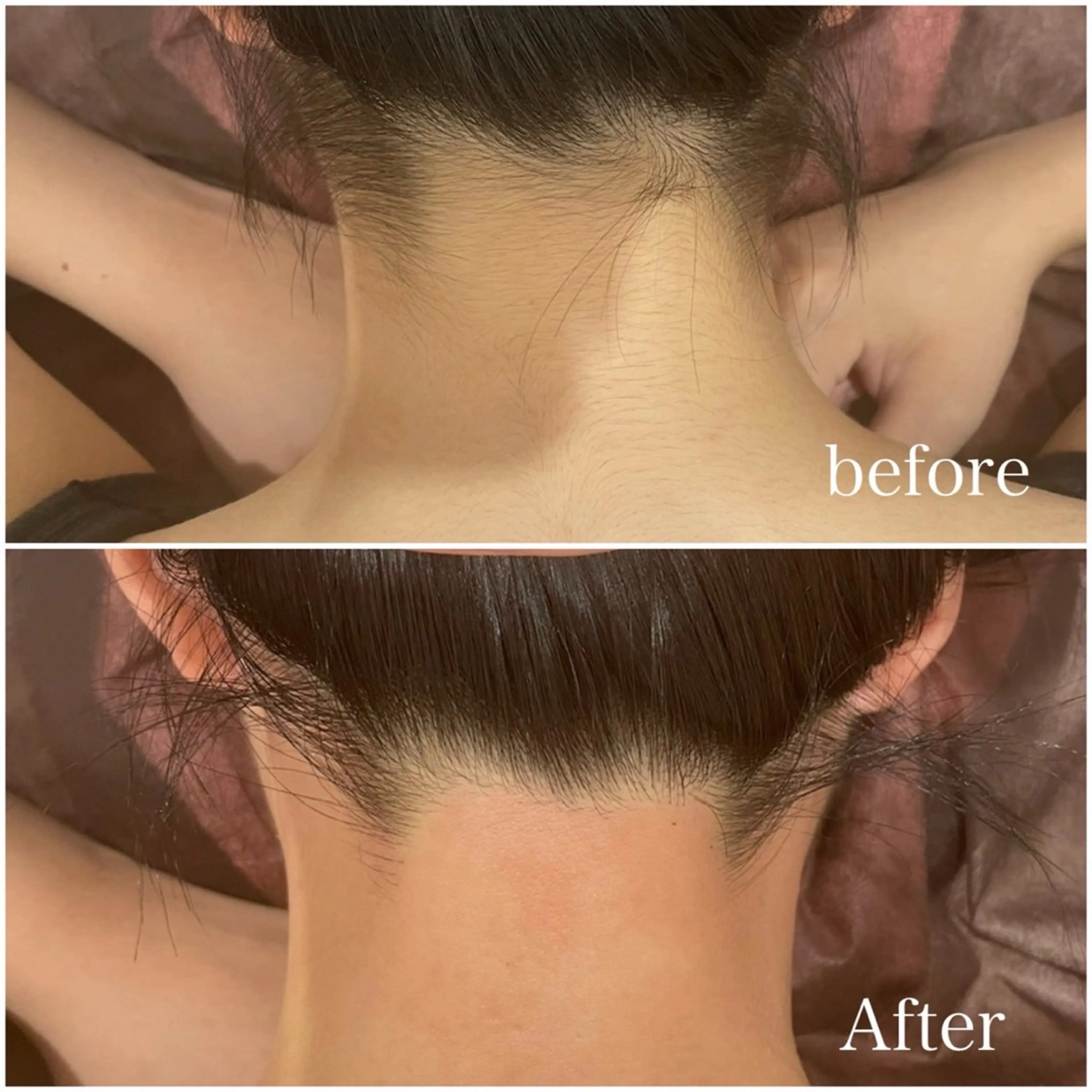 ロコミ必須✍️ 酒井限定⭐️うなじWAX脱毛モデル❣️入学式などアップスタイルを綺麗に✨注意事項をご理解頂ける方のみ⚠️の写真