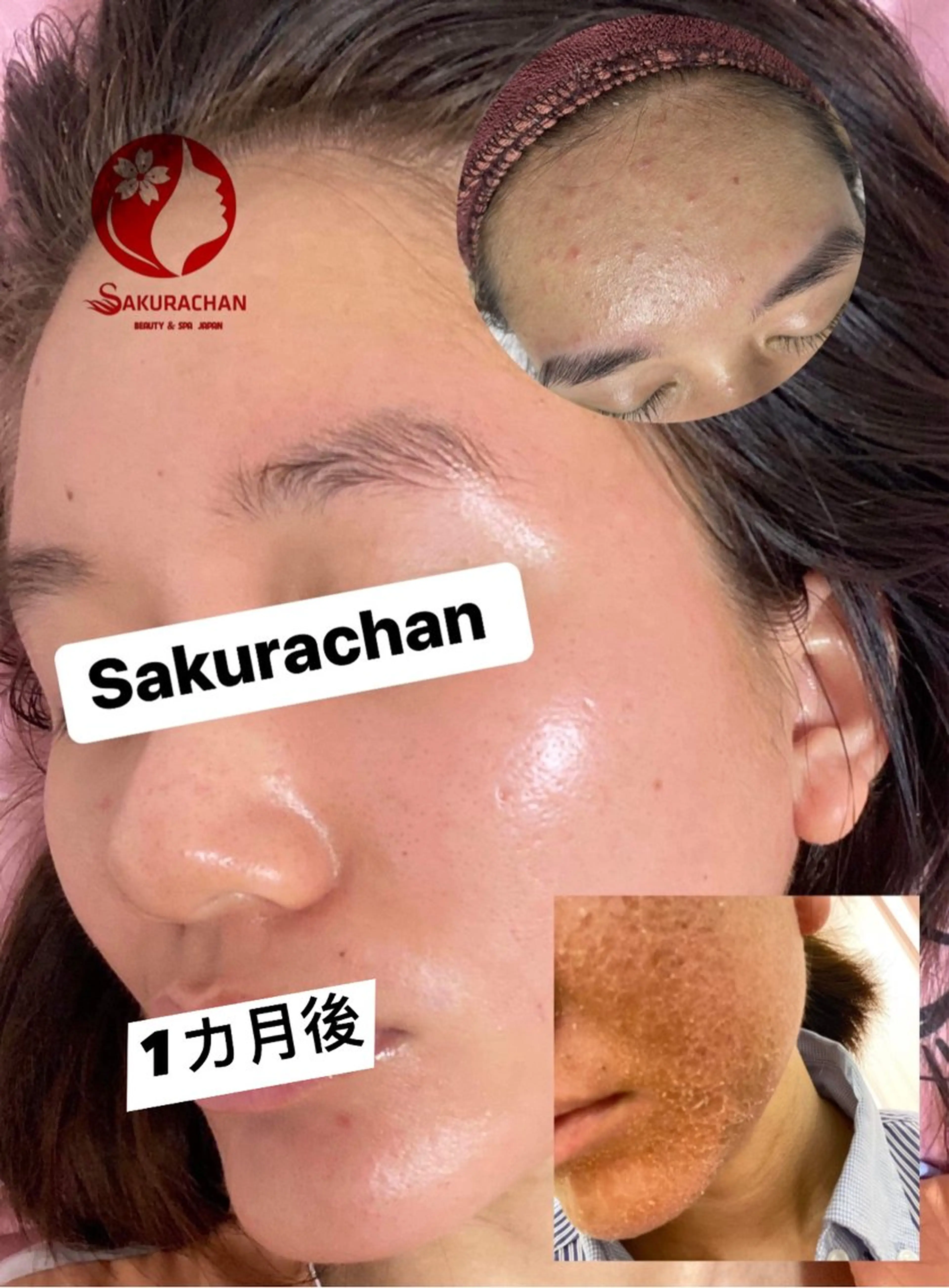 美肌，美ボディ，脱毛 サクラチャンスパのエステ・リラクイメージ