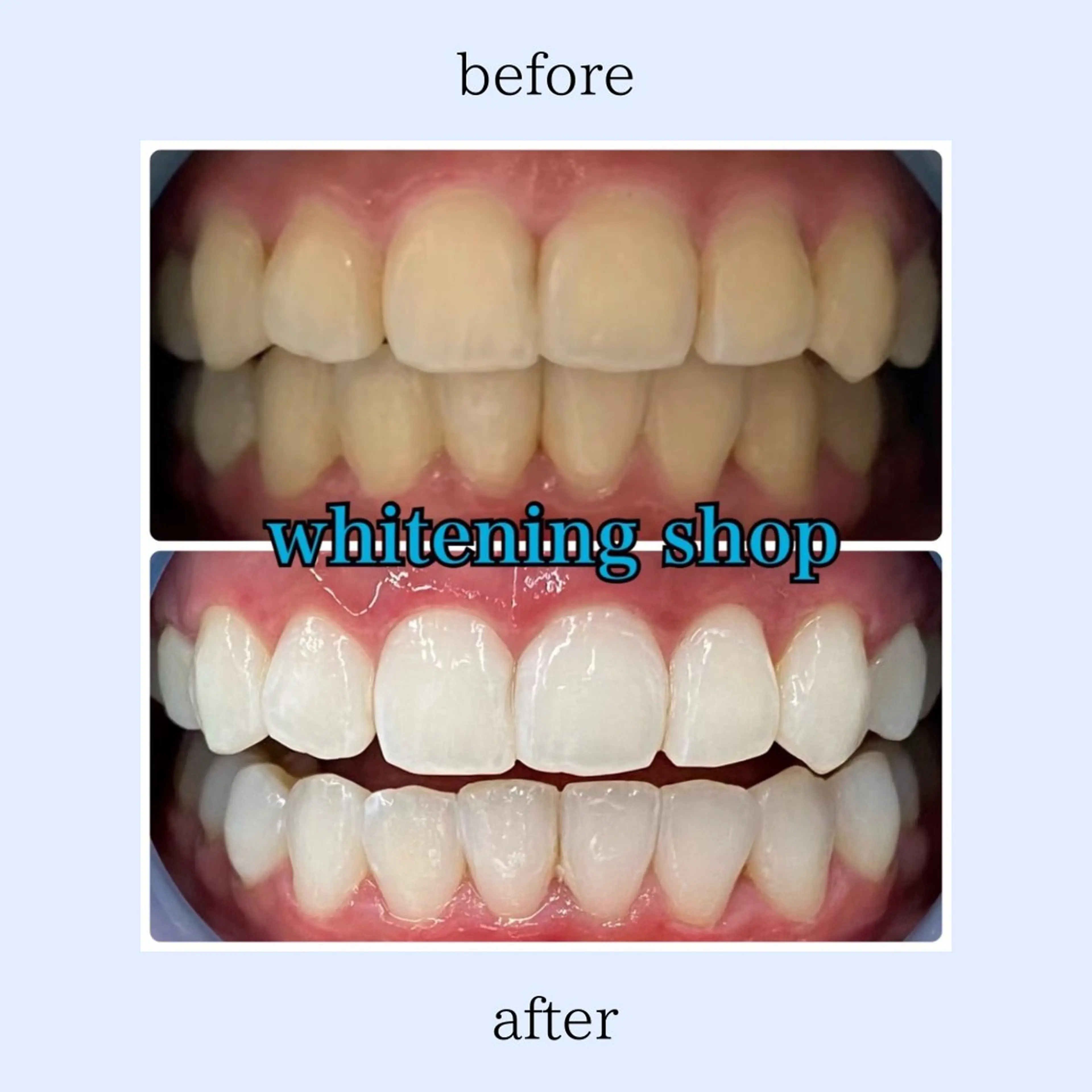 ホワイトニング ショップ伊丹店のその他イメージ