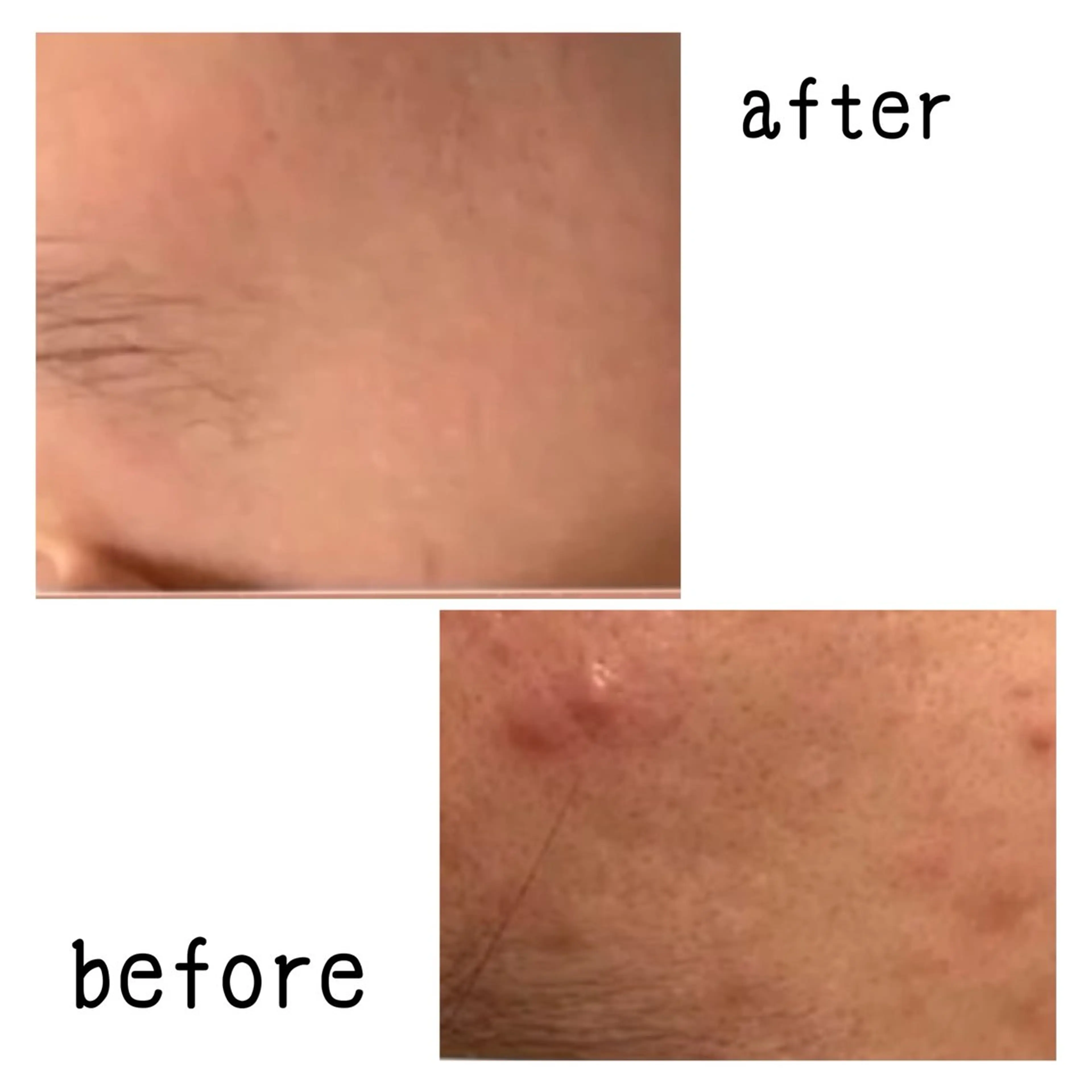 エステ リラク 目元・まつパ・美肌フ ェイシャル谷町四丁目のマツエク・マツパデザイン