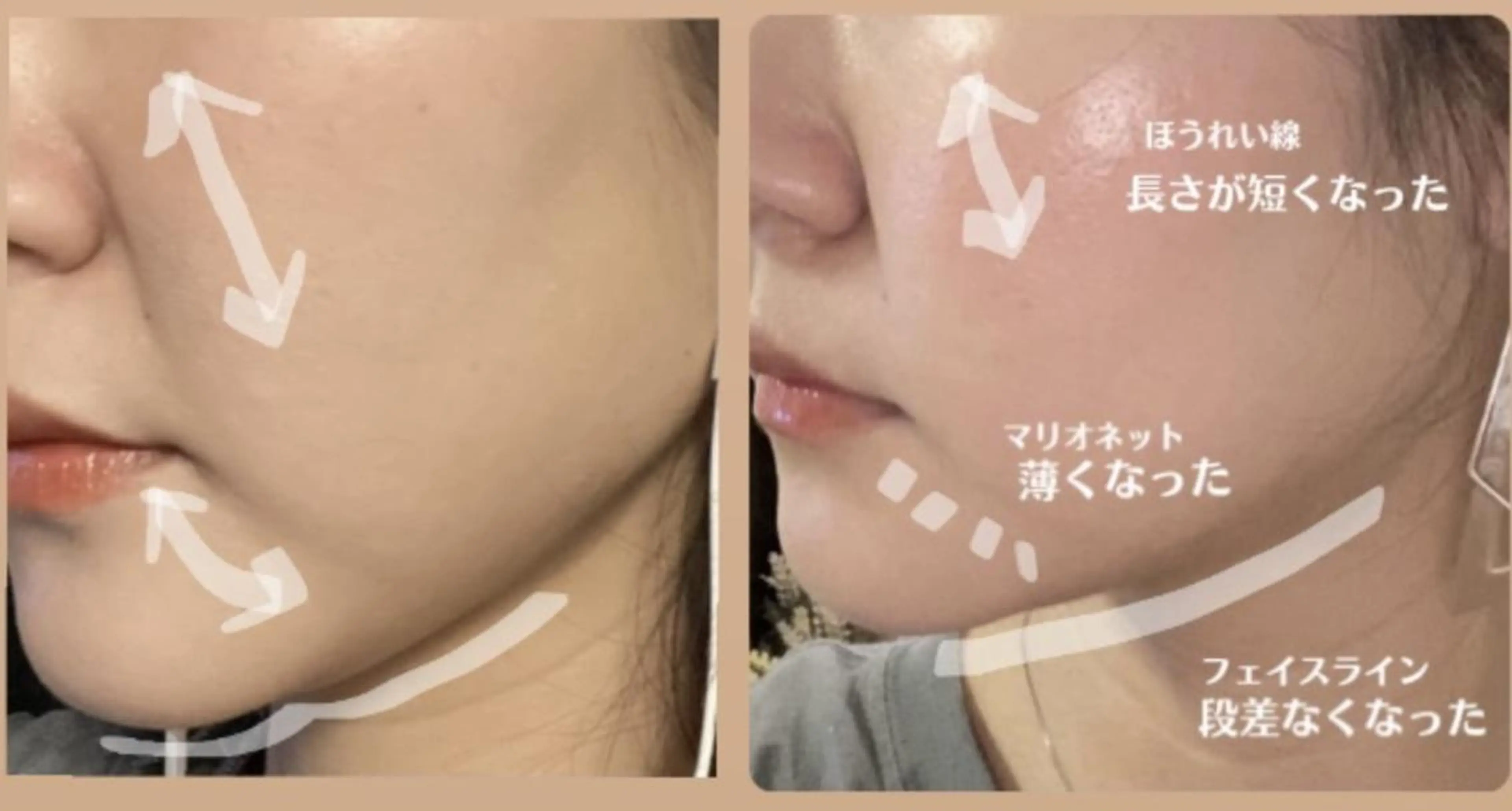 エステ OPREA 栄店のエステ・リラクイメージ