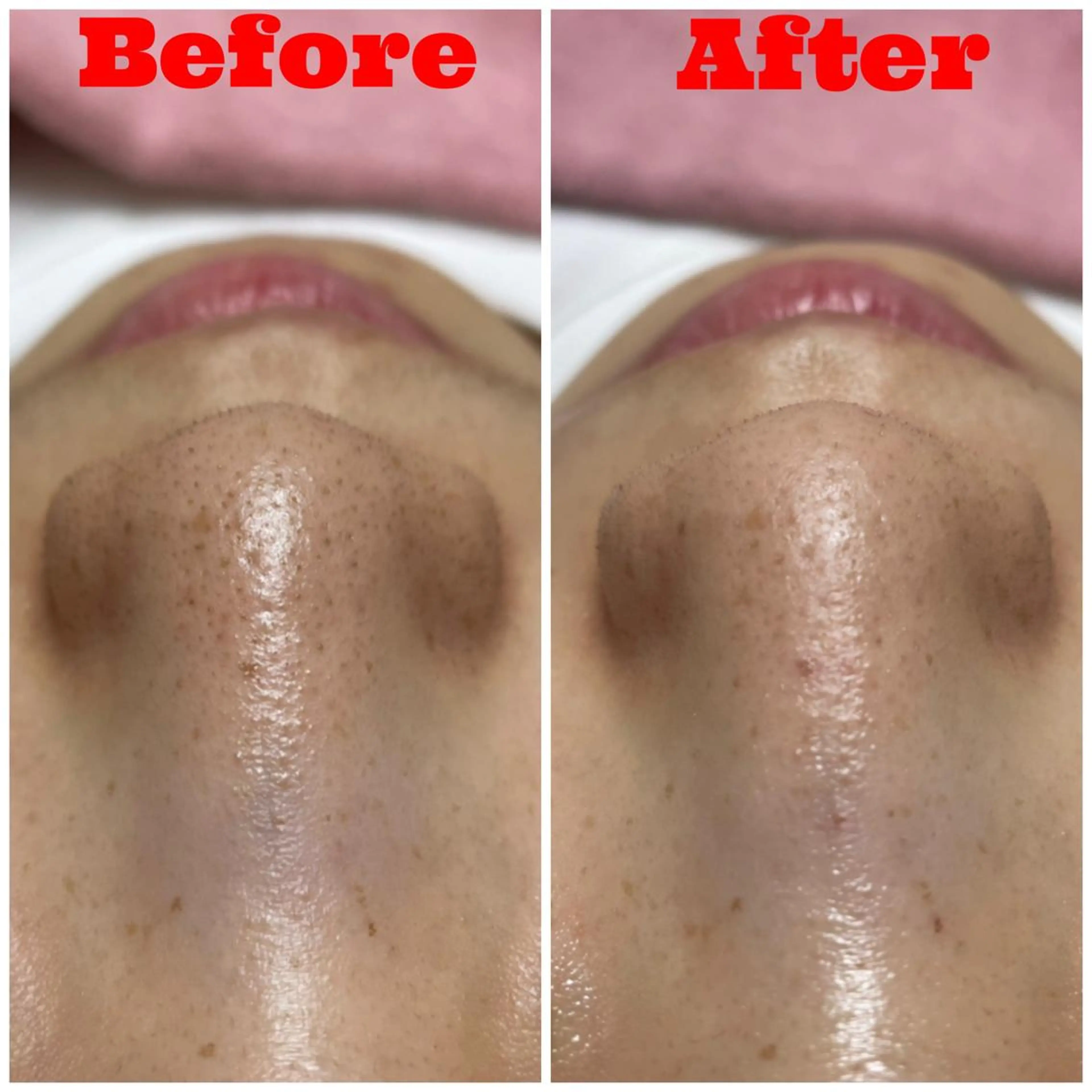 Linomalie エステ/たるみ/脱毛のエステ・リラクイメージ