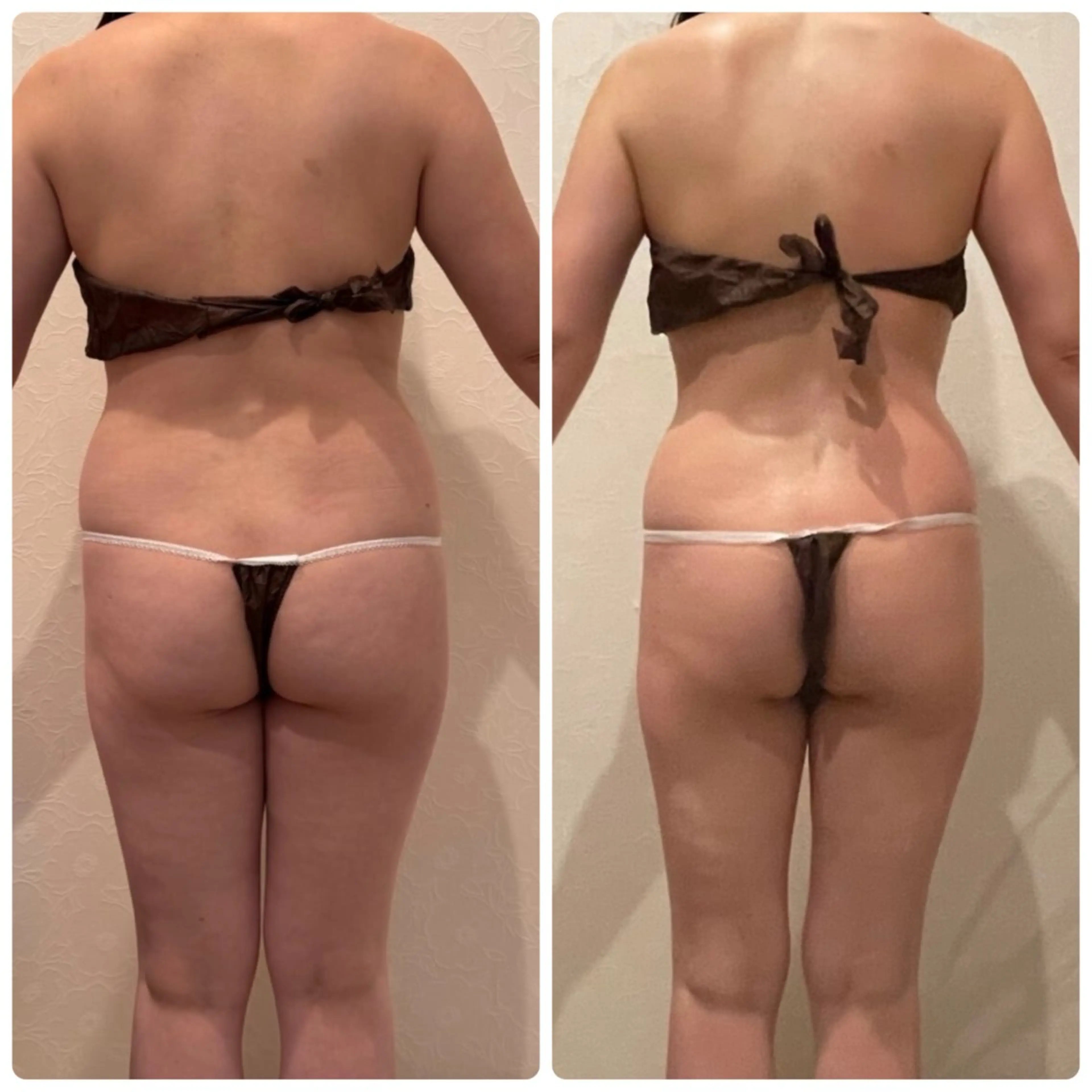 エステ 🦋痩身専門サロン Re:oasis🦋のエステ・リラクイメージ