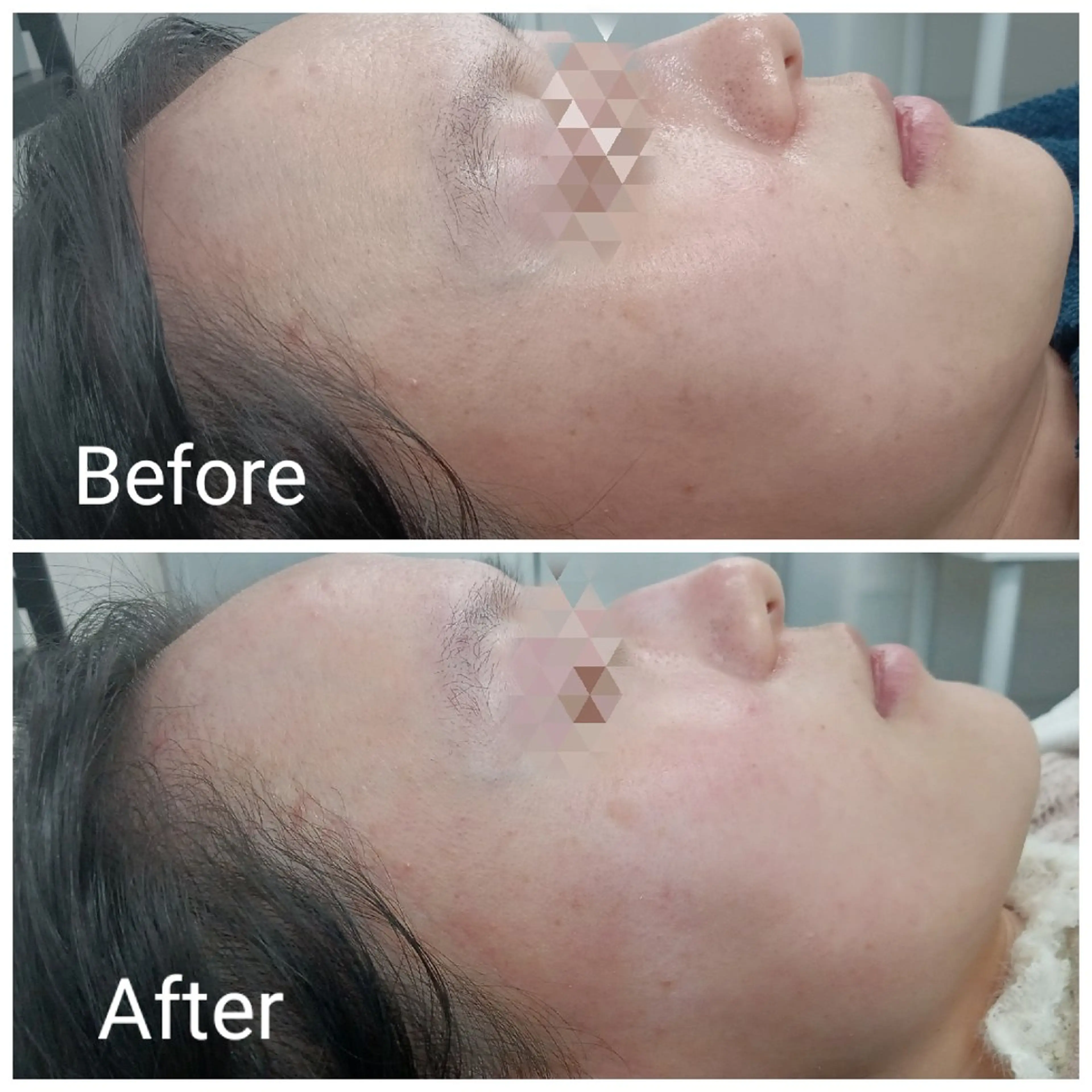 エステ リラク 肌質改善Beauty salon Renのエステ・リラクイメージ