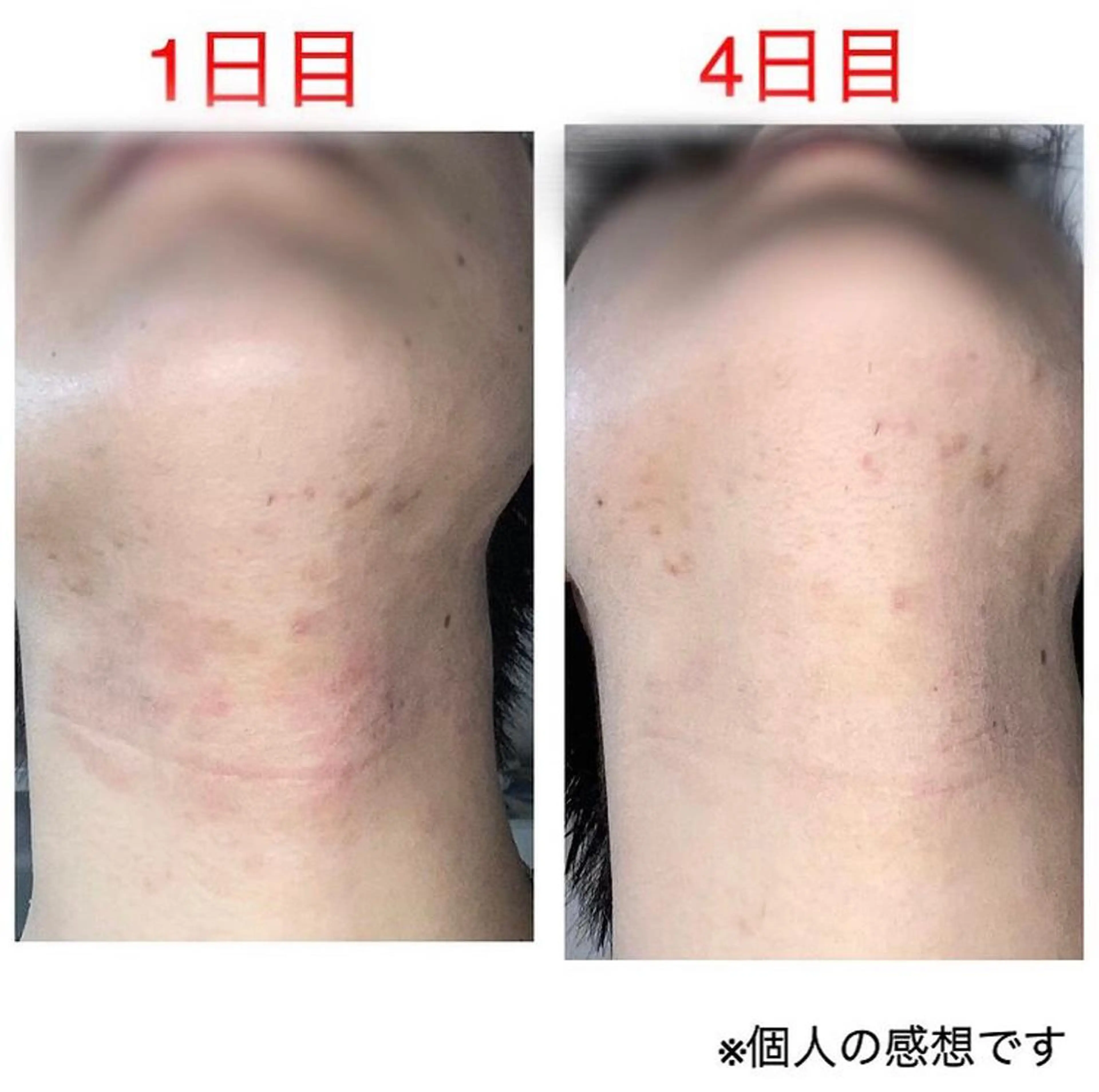 tominaga ryokoのヘアスタイル