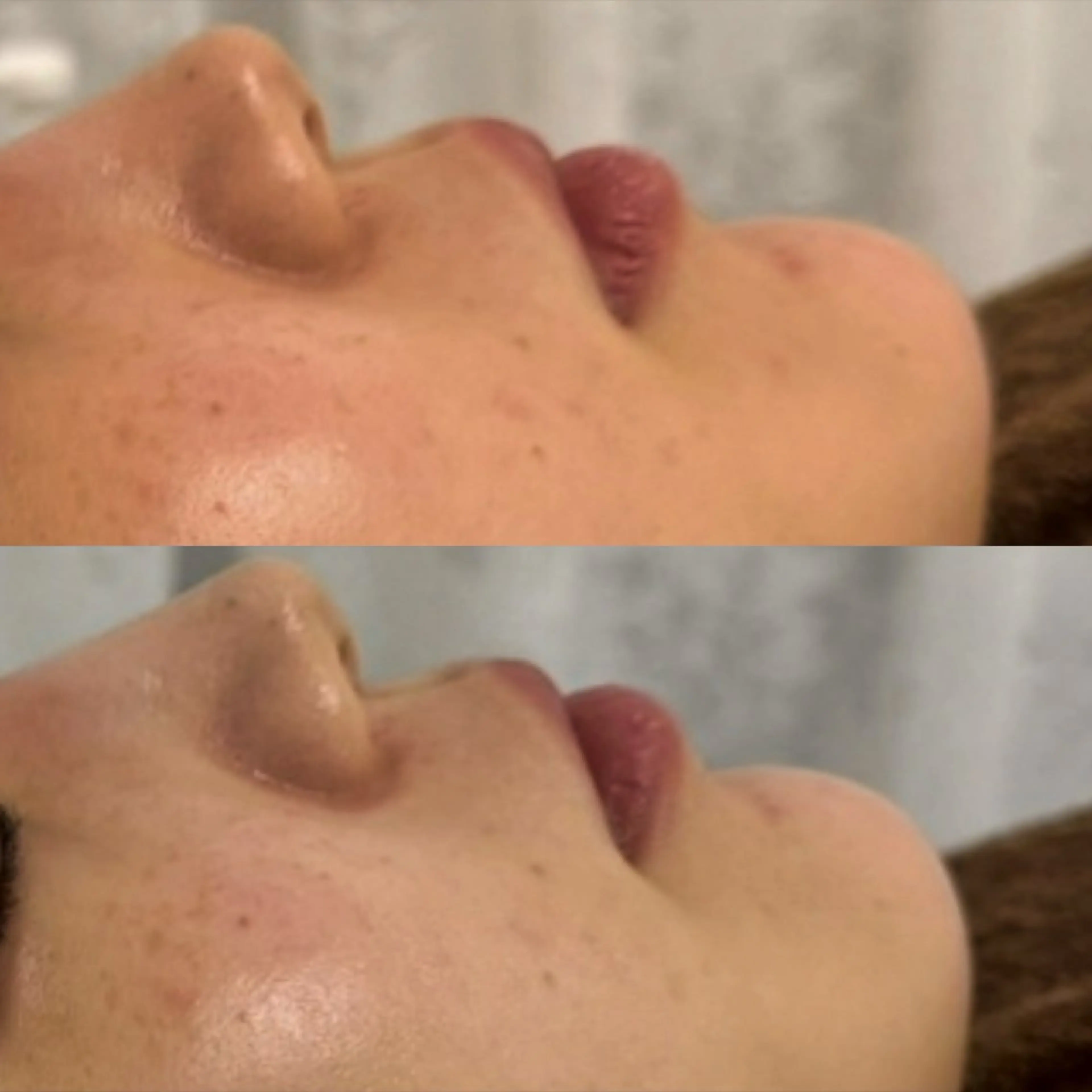 肌育専門ナース❗️ みのり／ナスサロのエステ・リラクイメージ