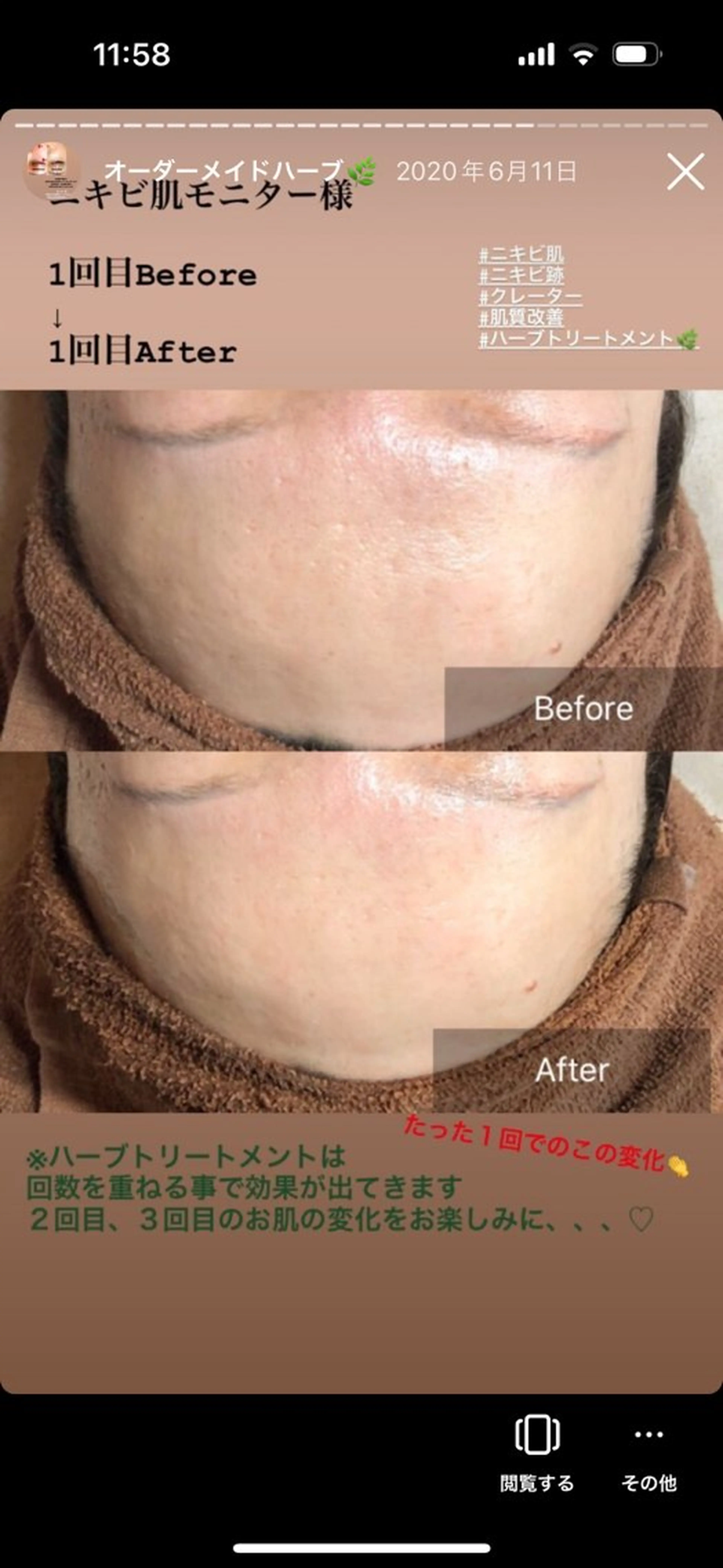 エステ 齋藤 祐里耶のエステ・リラクイメージ