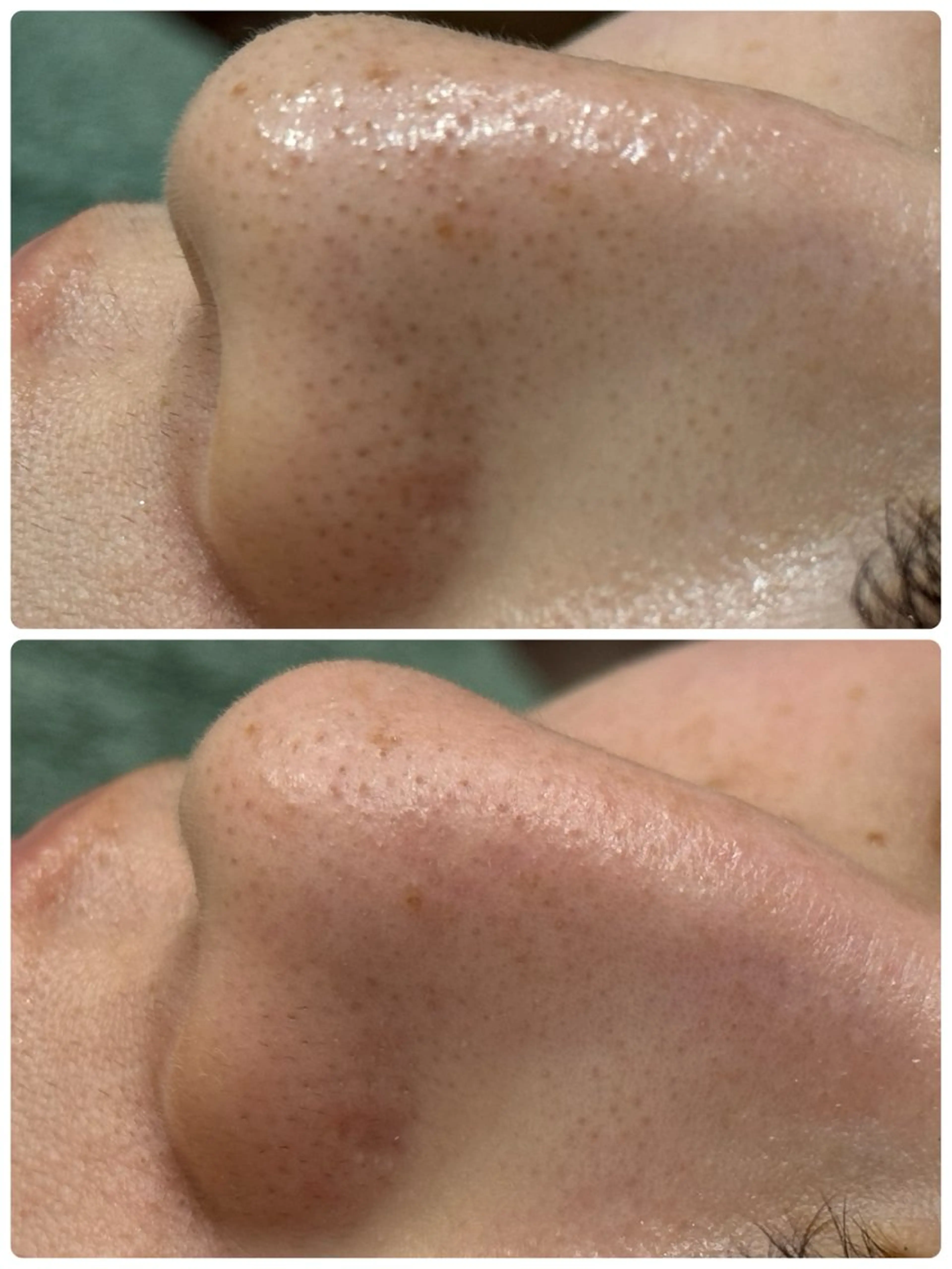 脱毛&フェイシャル 専門店muro.のエステ・リラクイメージ