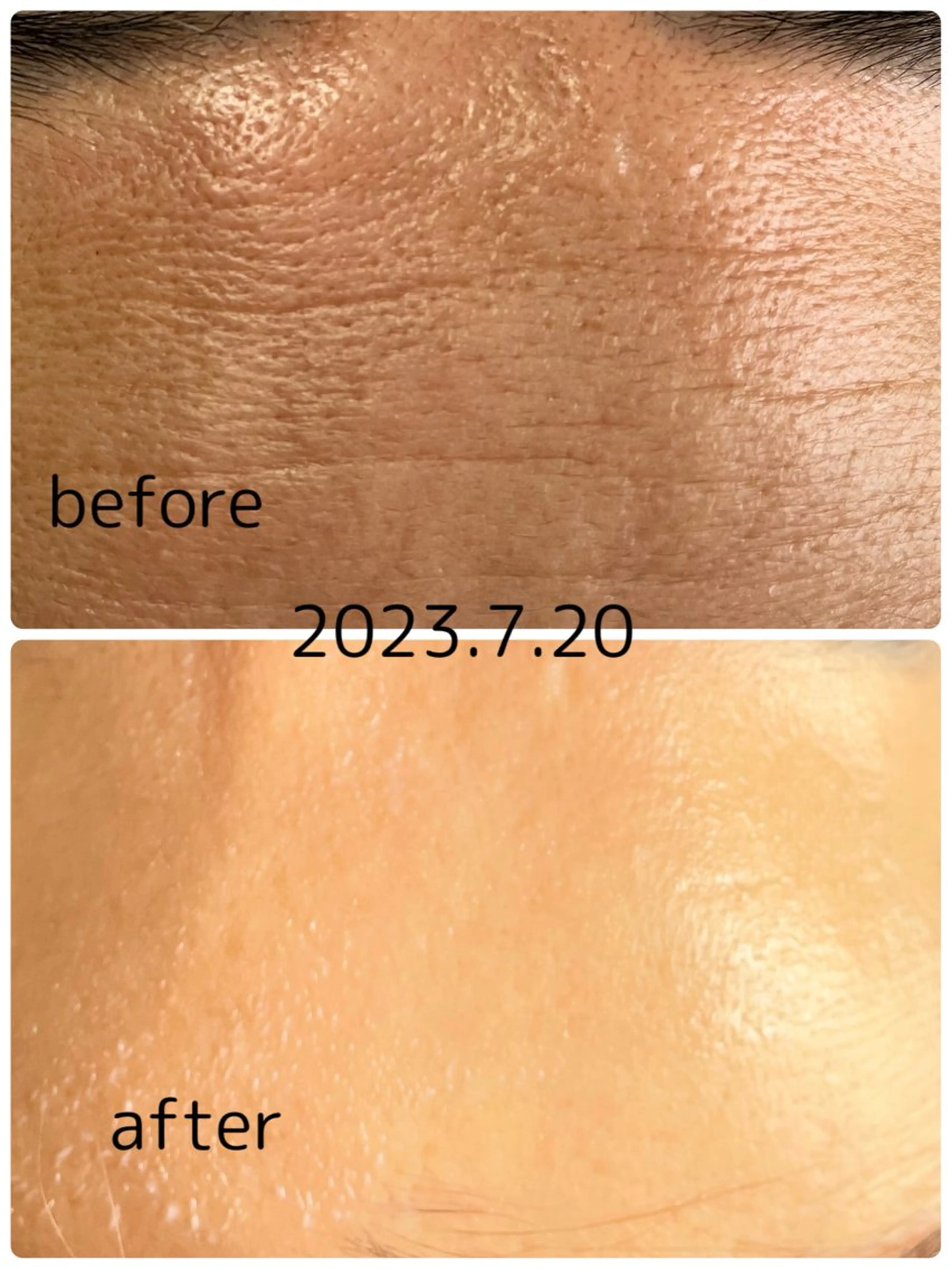 エステ リラク YURUMARU 河ノ瀬店のエステ・リラクイメージ