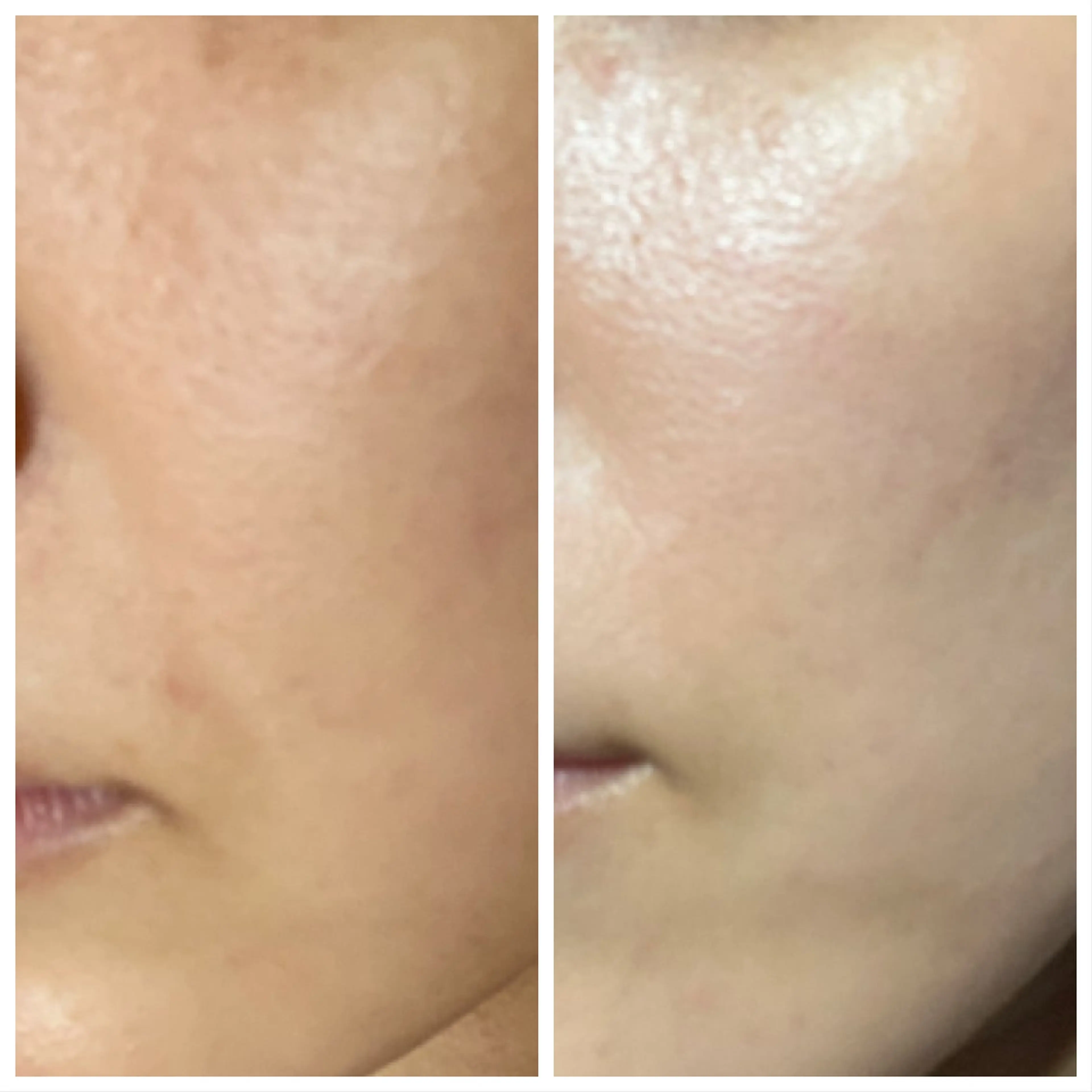 【小顔矯正】 salonaceのエステ・リラクイメージ