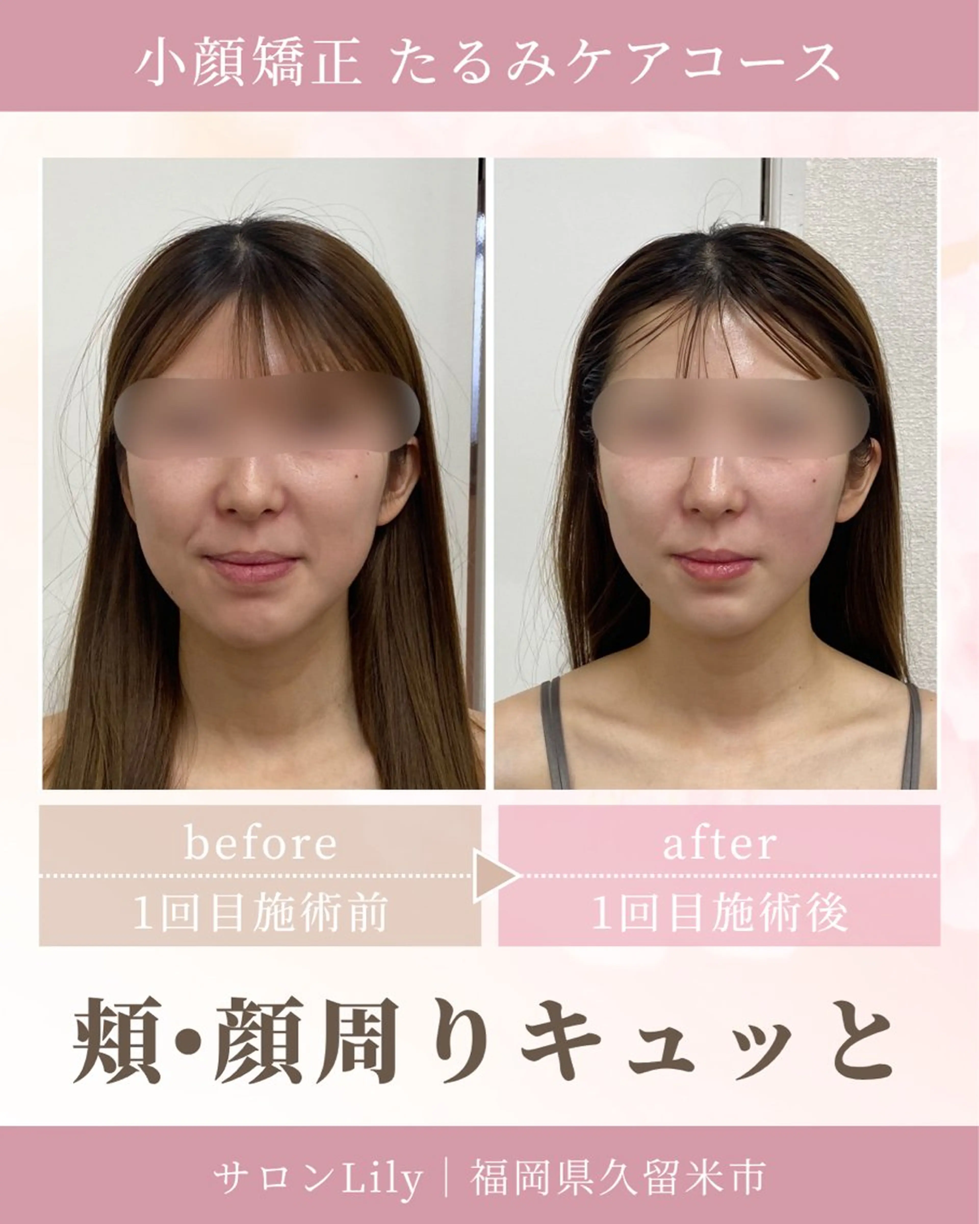 小顔矯正サロン Lilyのエステ・リラクイメージ