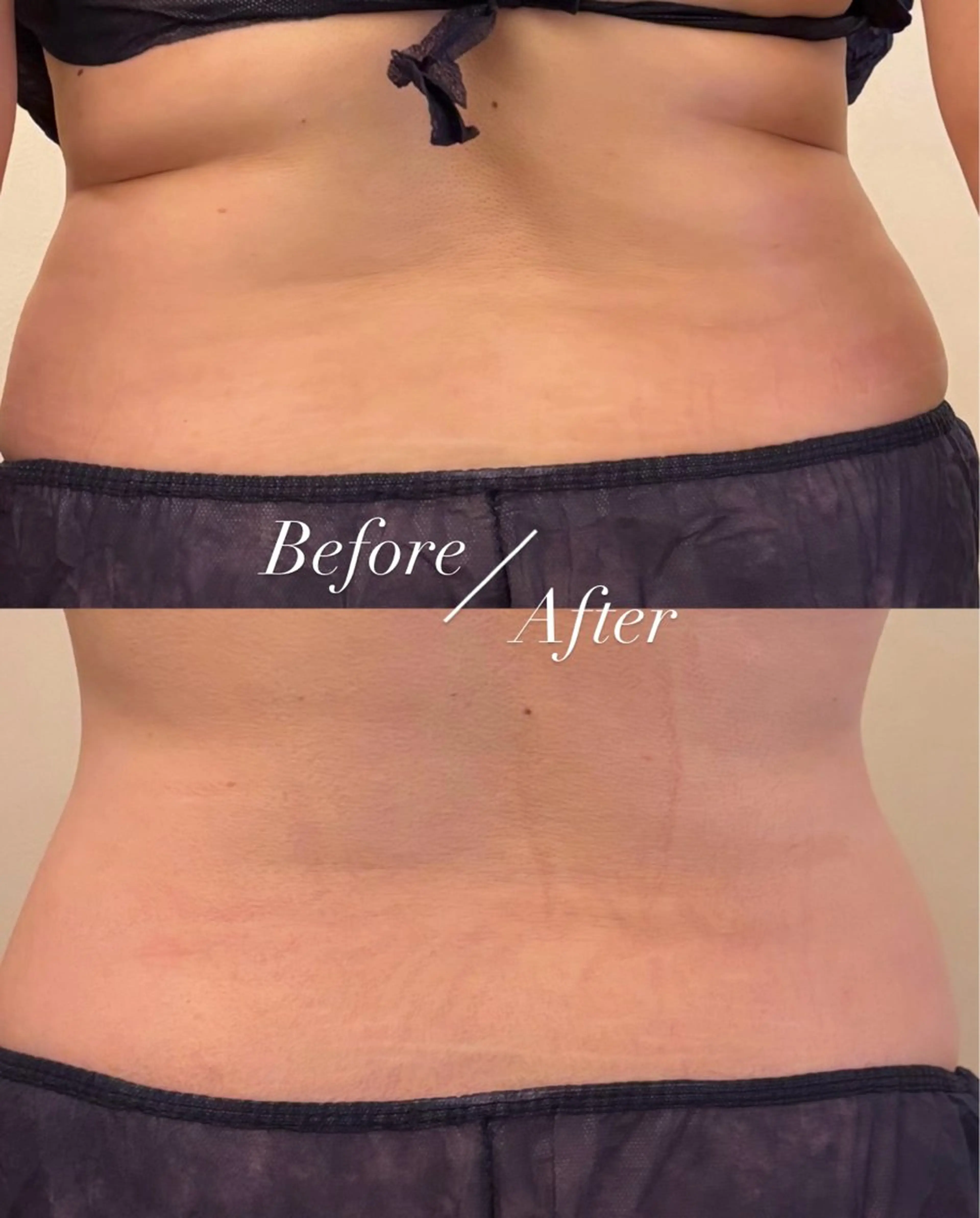 リラク Ellebeauty relaxationのエステ・リラクイメージ