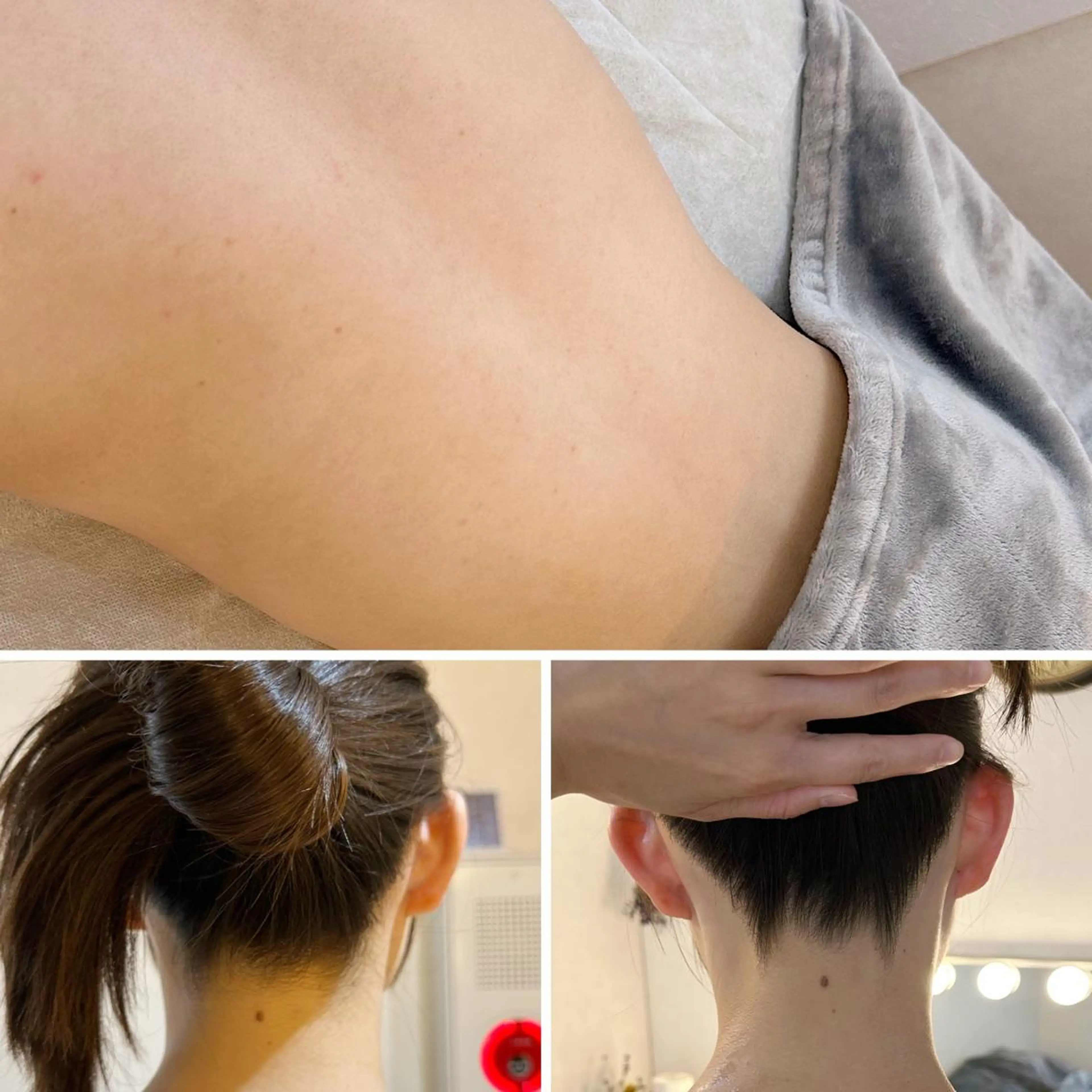 脱毛 うなじ脱毛/美肌脱毛 LABELのエステ・リラクイメージ