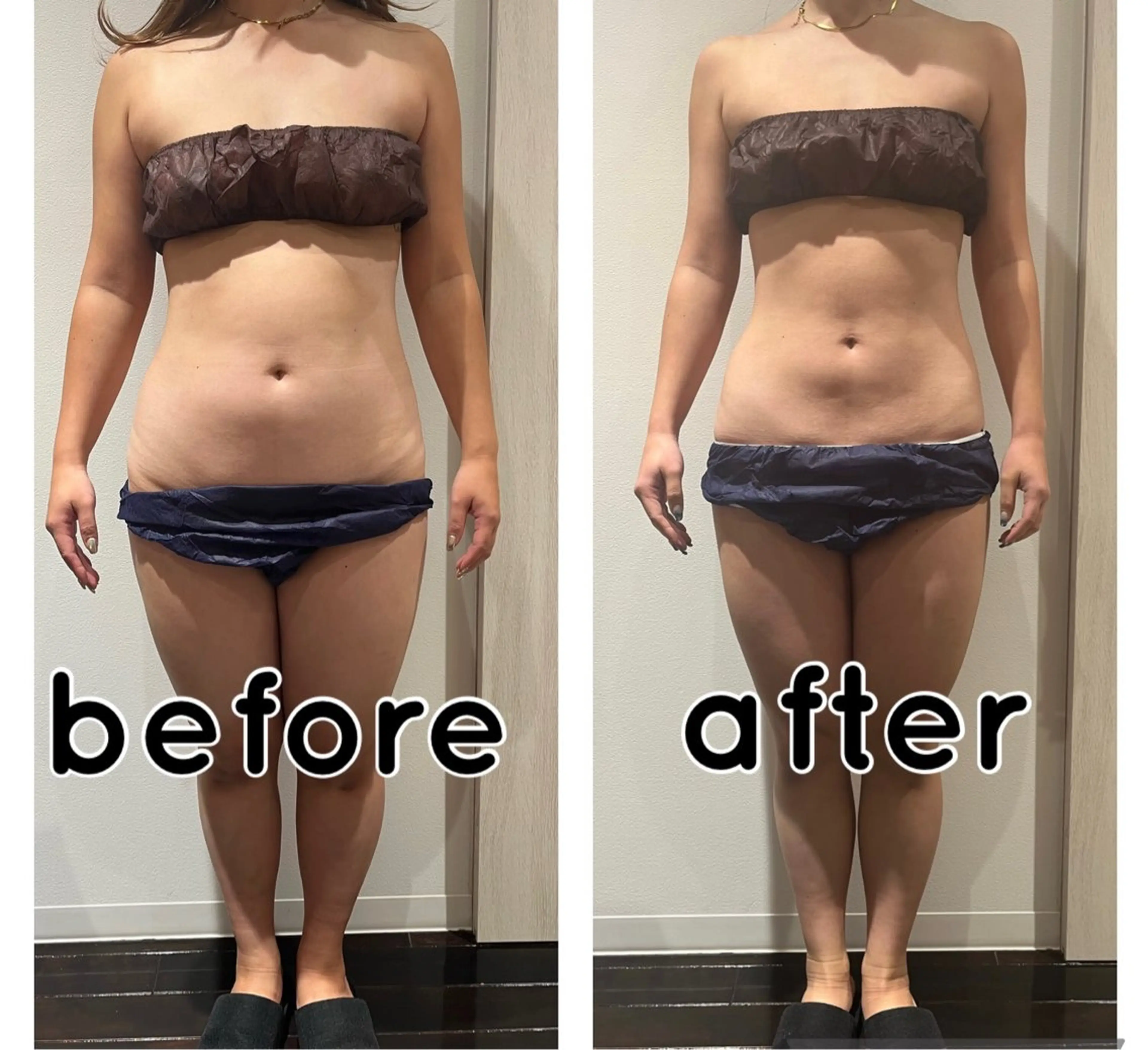 エステ 脱毛フェイシャル痩身 エリア最安👑永野舞のエステ・リラクイメージ