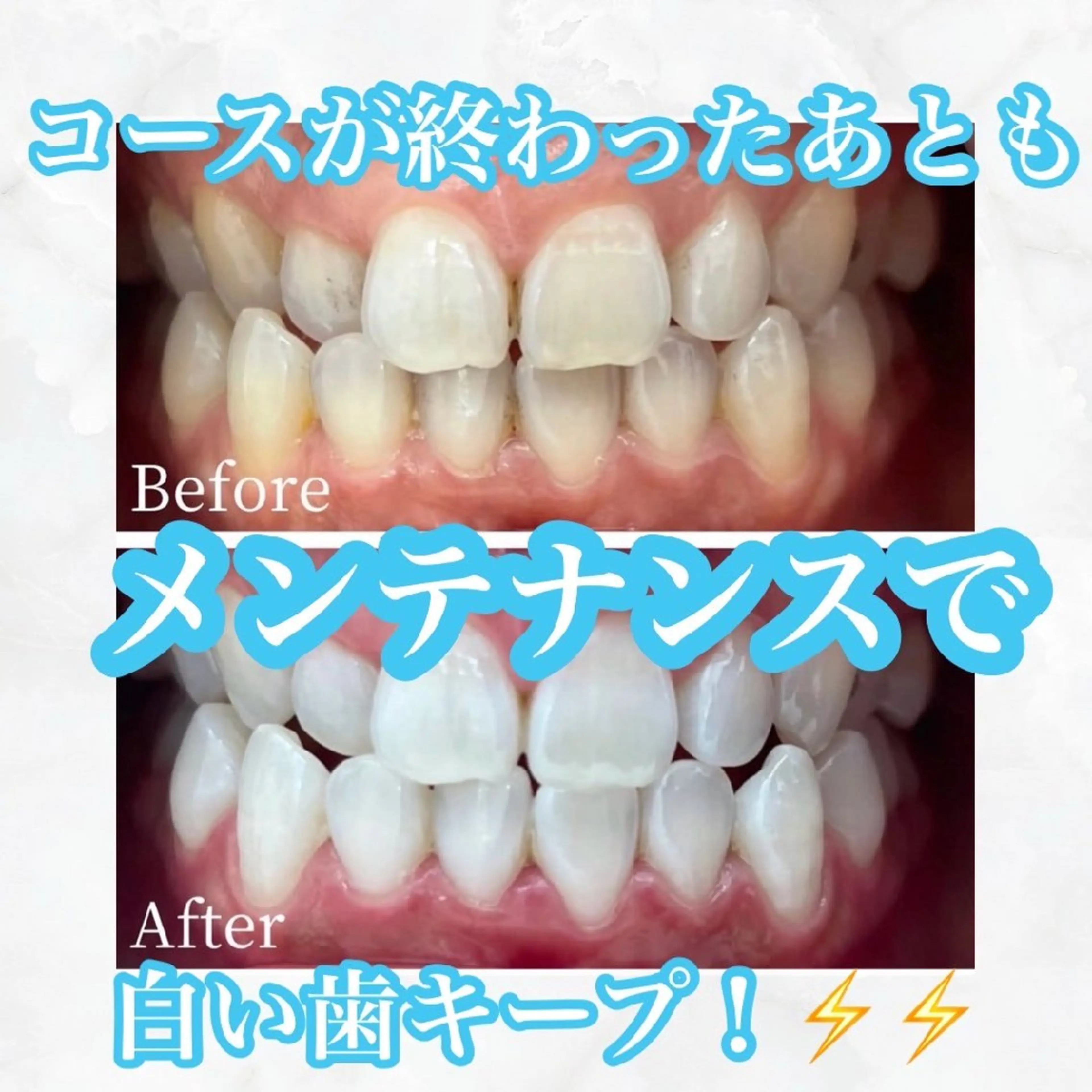 メンズ キッズ 撮影モデル セルフホワイトニング WHITE福岡博多店のエステ・リラクイメージ