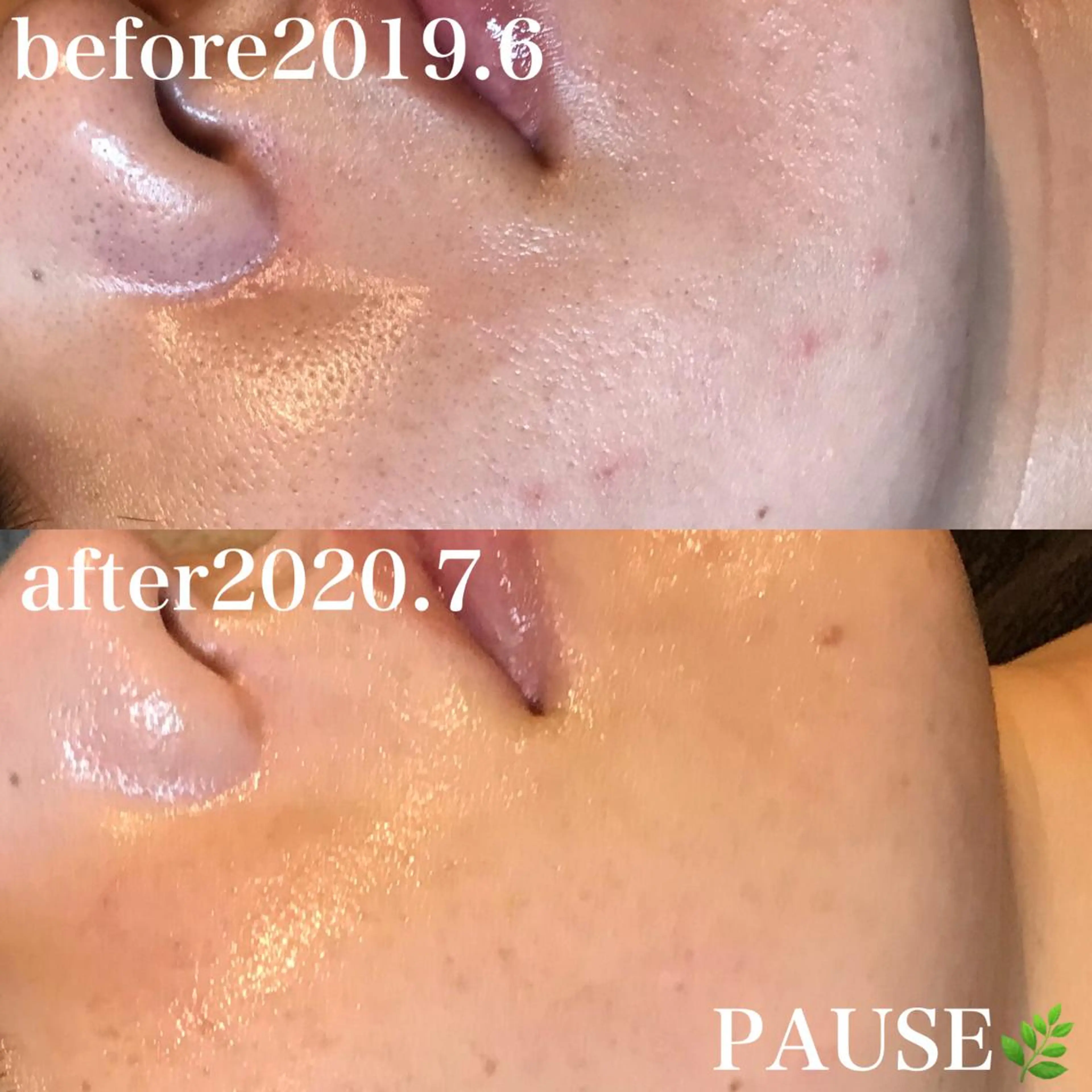 エステ 浜野 恵美のエステ・リラクイメージ