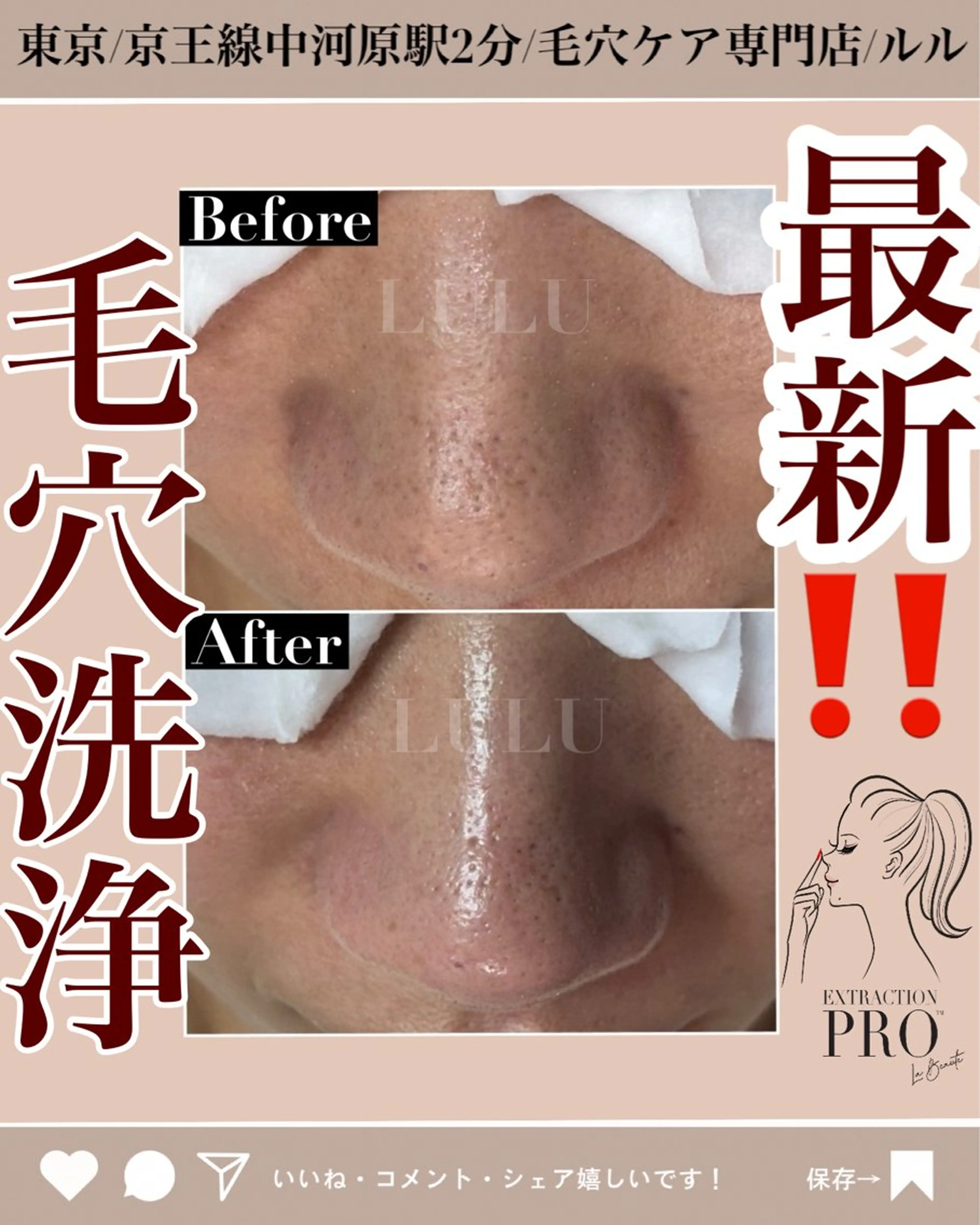 エステ LULU ルルのエステ・リラクイメージ