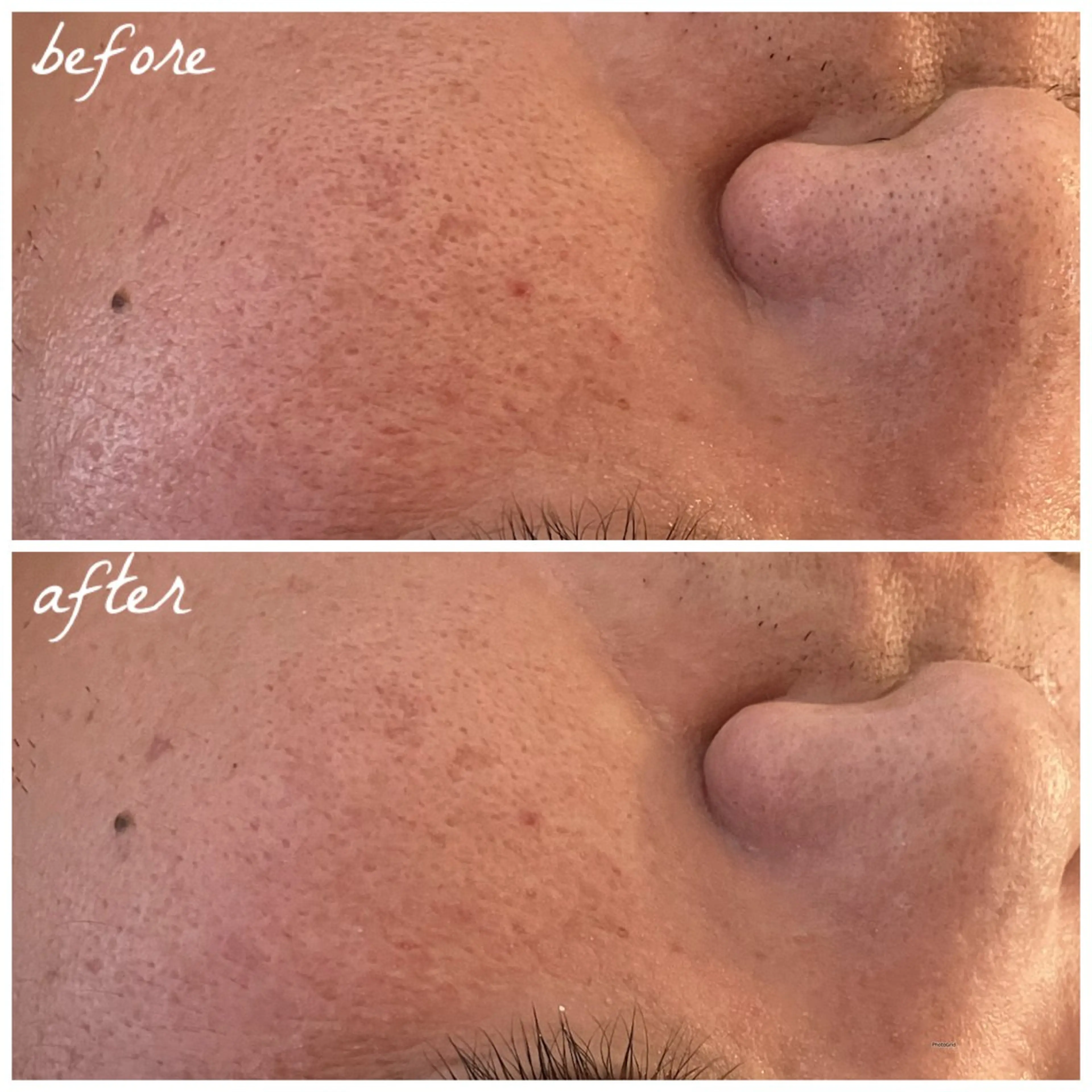 メンズ エステ メナード岐阜茜部 杉浦のエステ・リラクイメージ