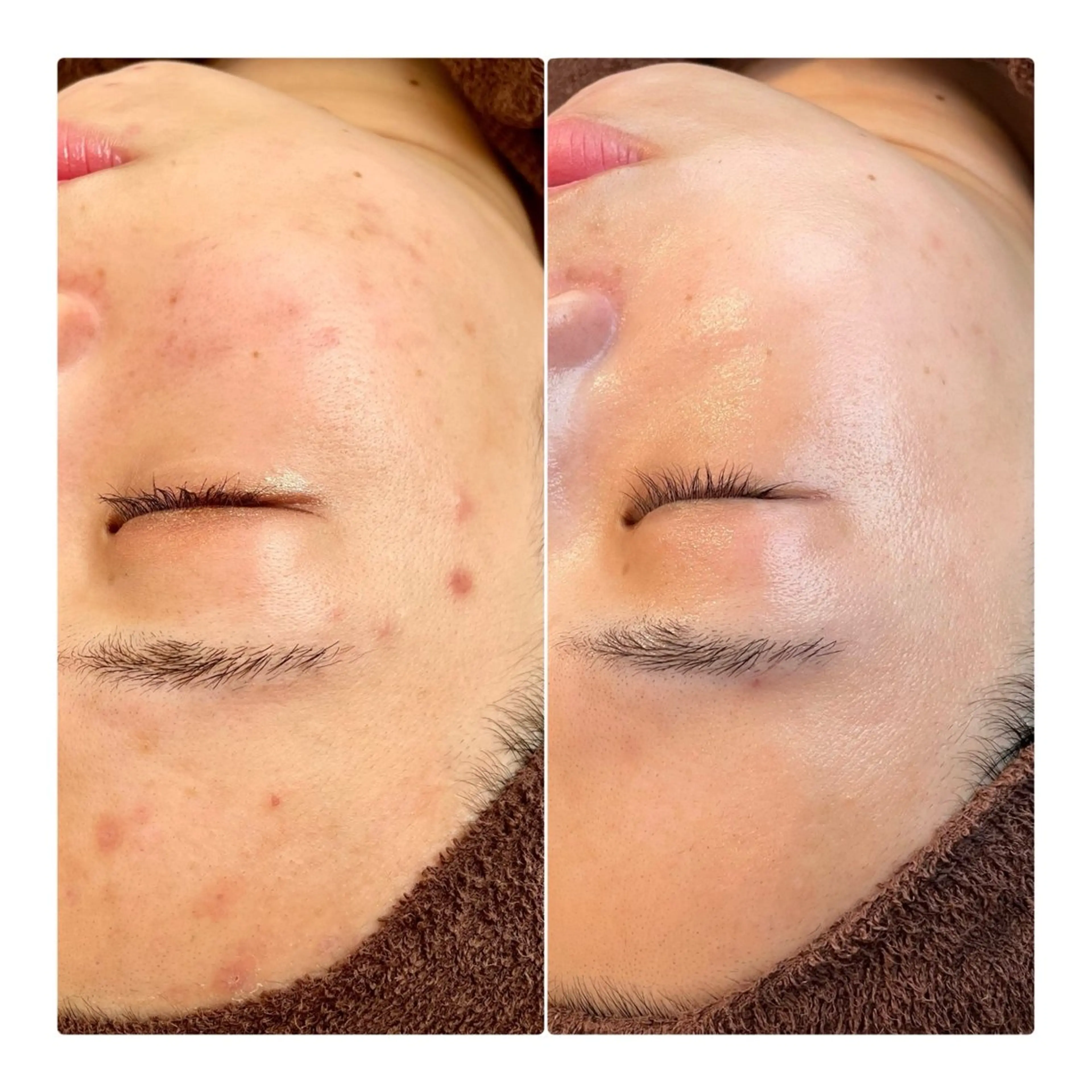 エステ リラク íam natsukiのエステ・リラクイメージ